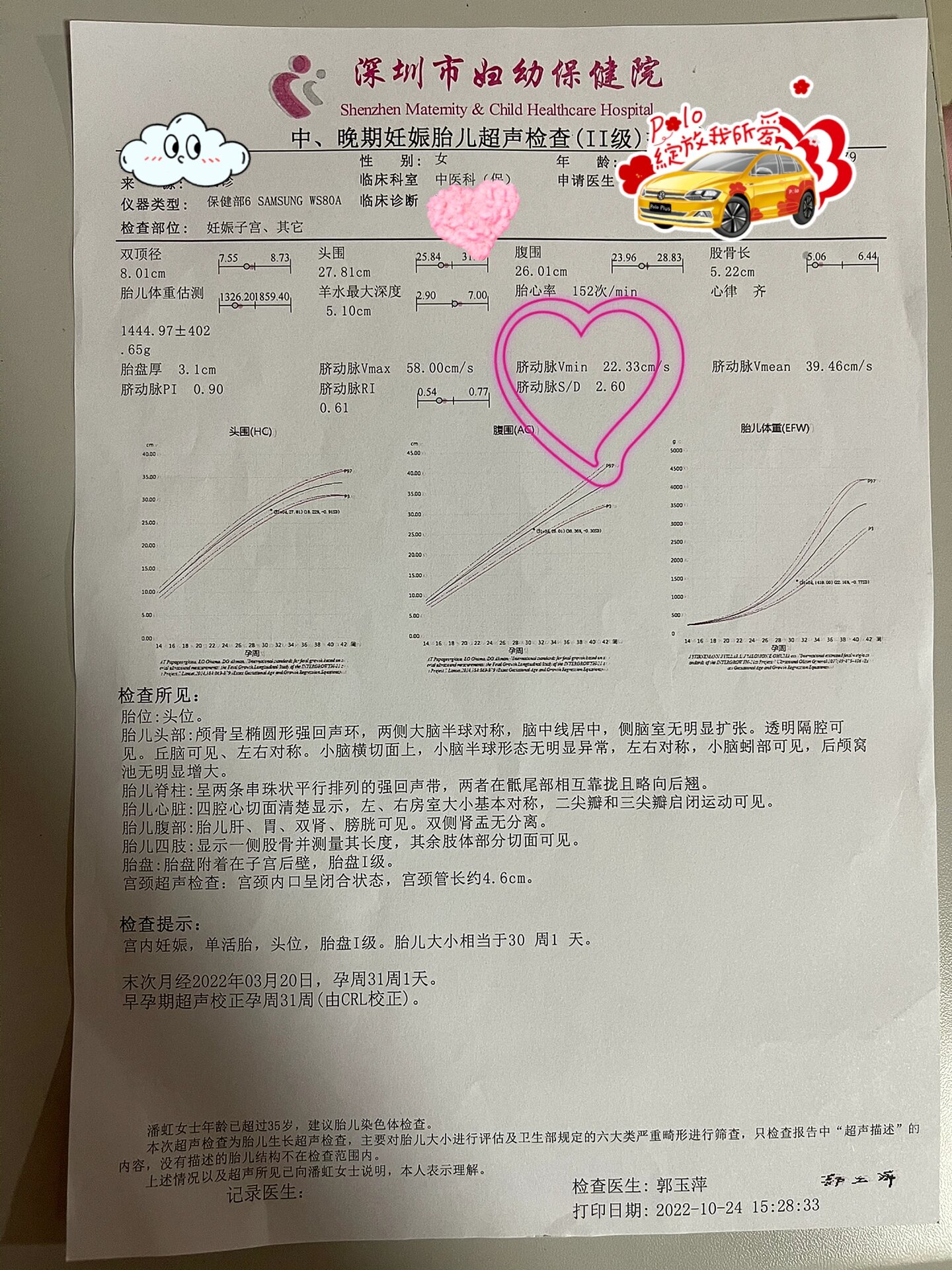 脐动脉sd正常值