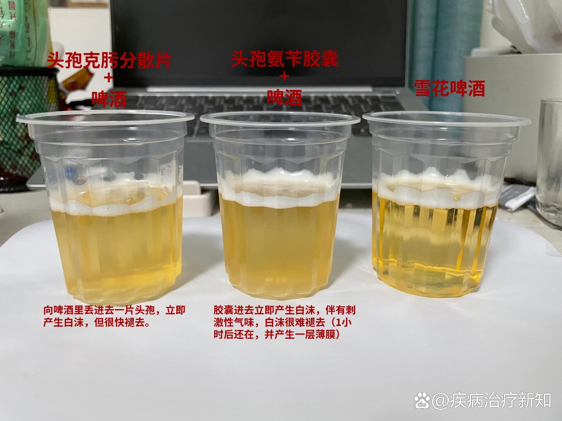 输头孢多久能喝酒图片