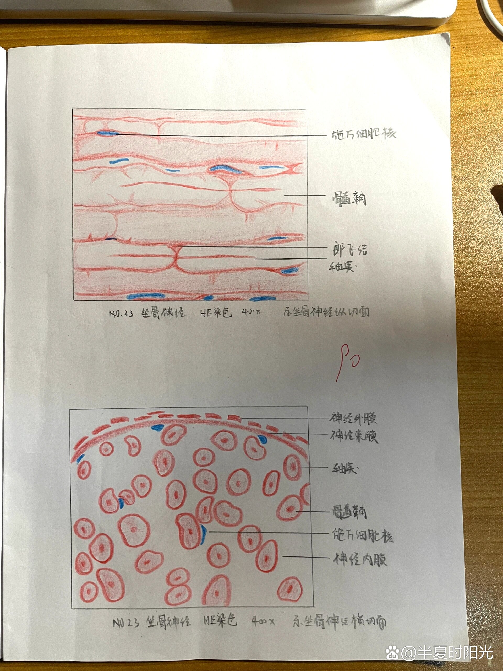 神经纤维束切片图片