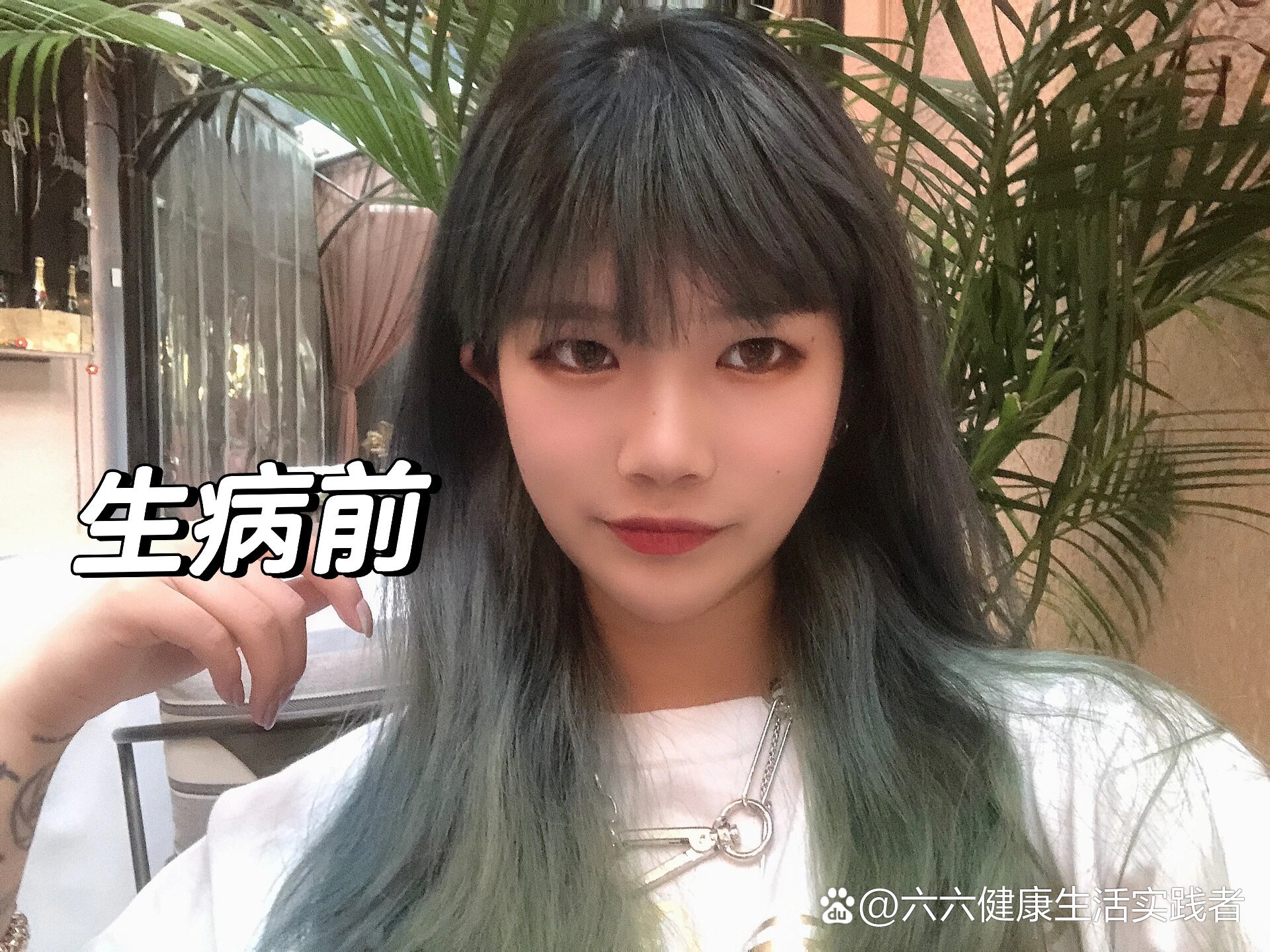 红斑狼疮第三年.