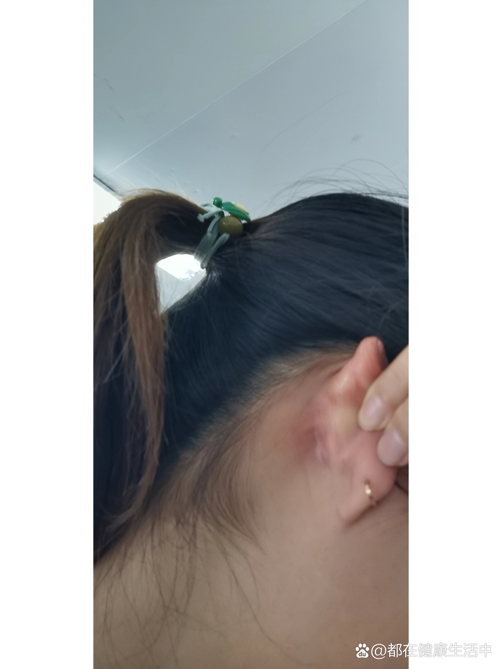 耳朵后面长了个小包