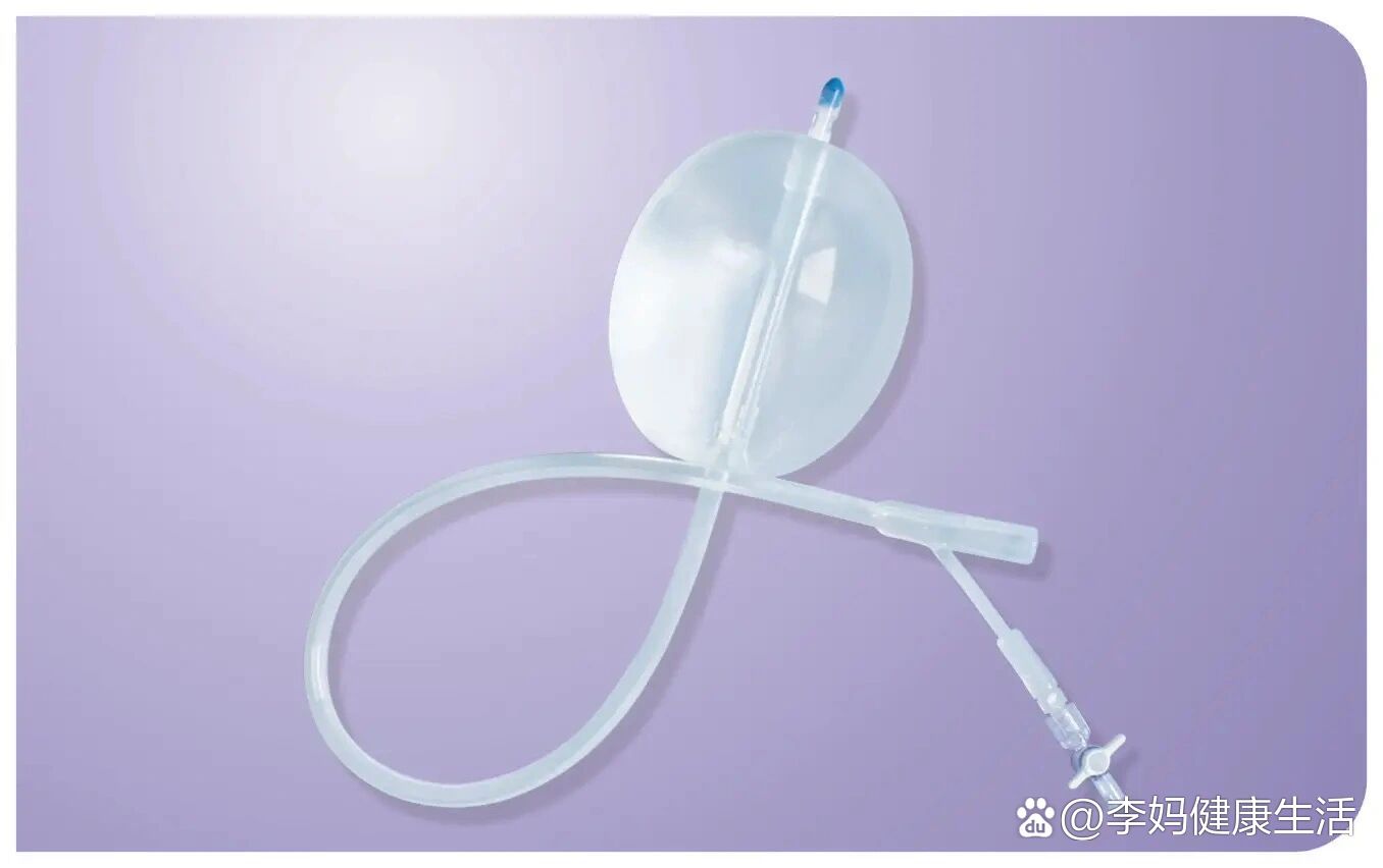 你们做宫腔镜用的哪种球囊?