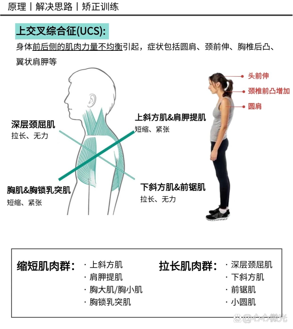 上交叉综合症图图片