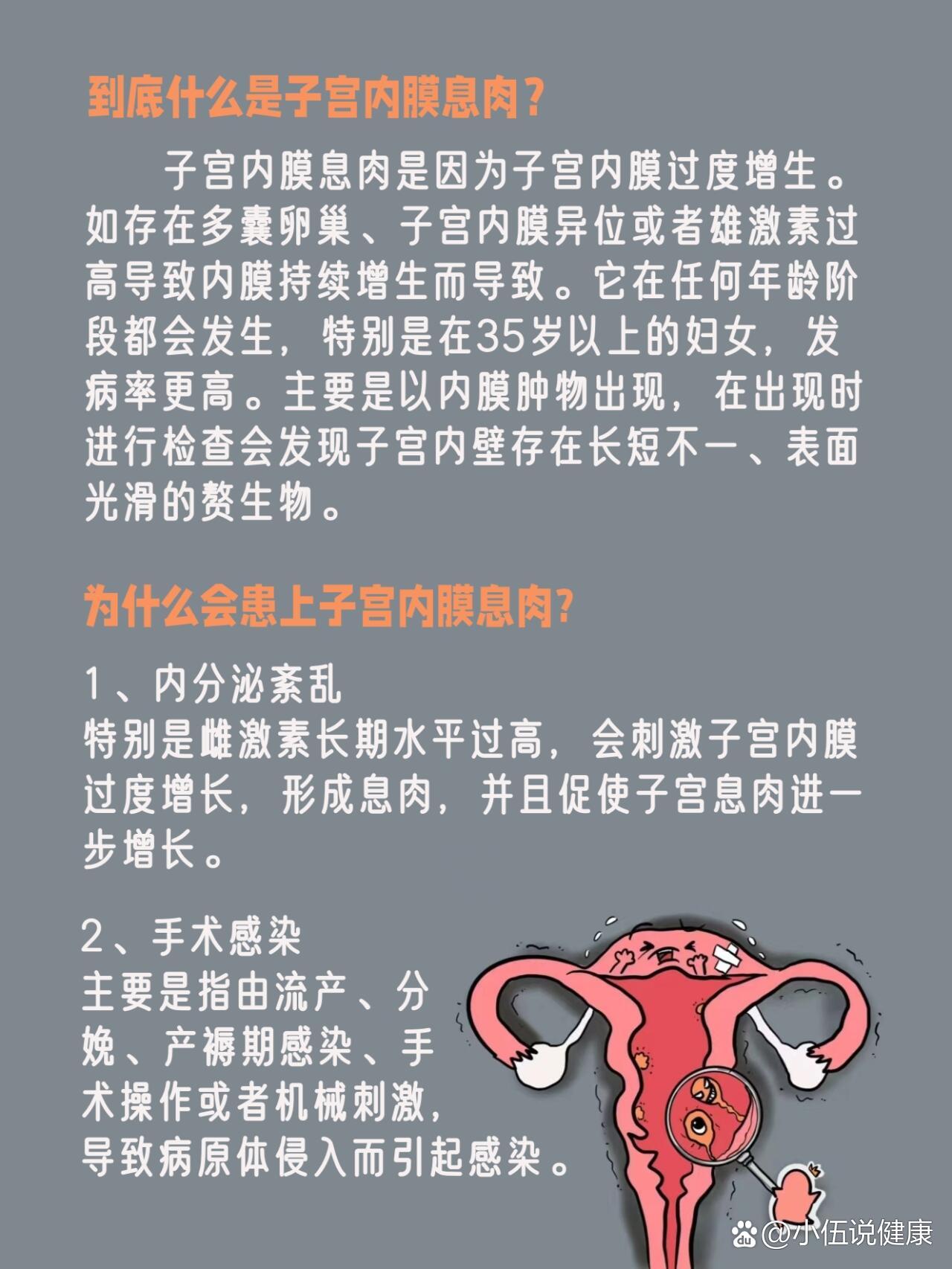 宫颈蜕膜息肉图片图片