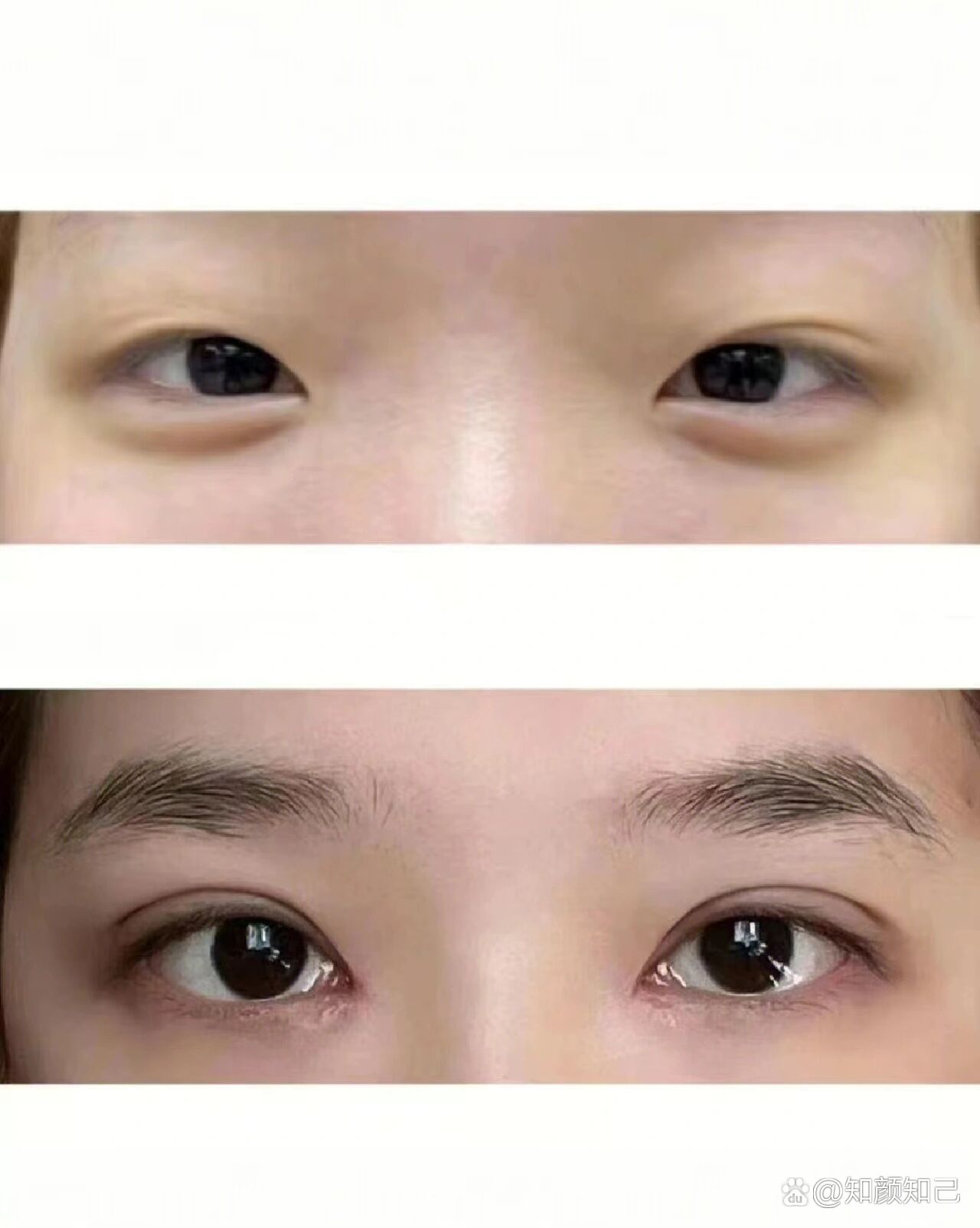 开扇双眼皮太好看啦!