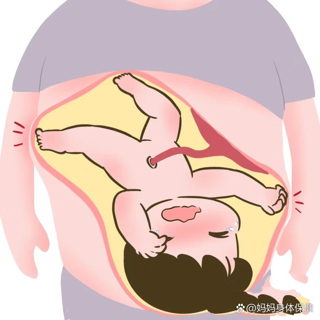 为啥胎动肚子两边同时鼓包,直到我看到了这