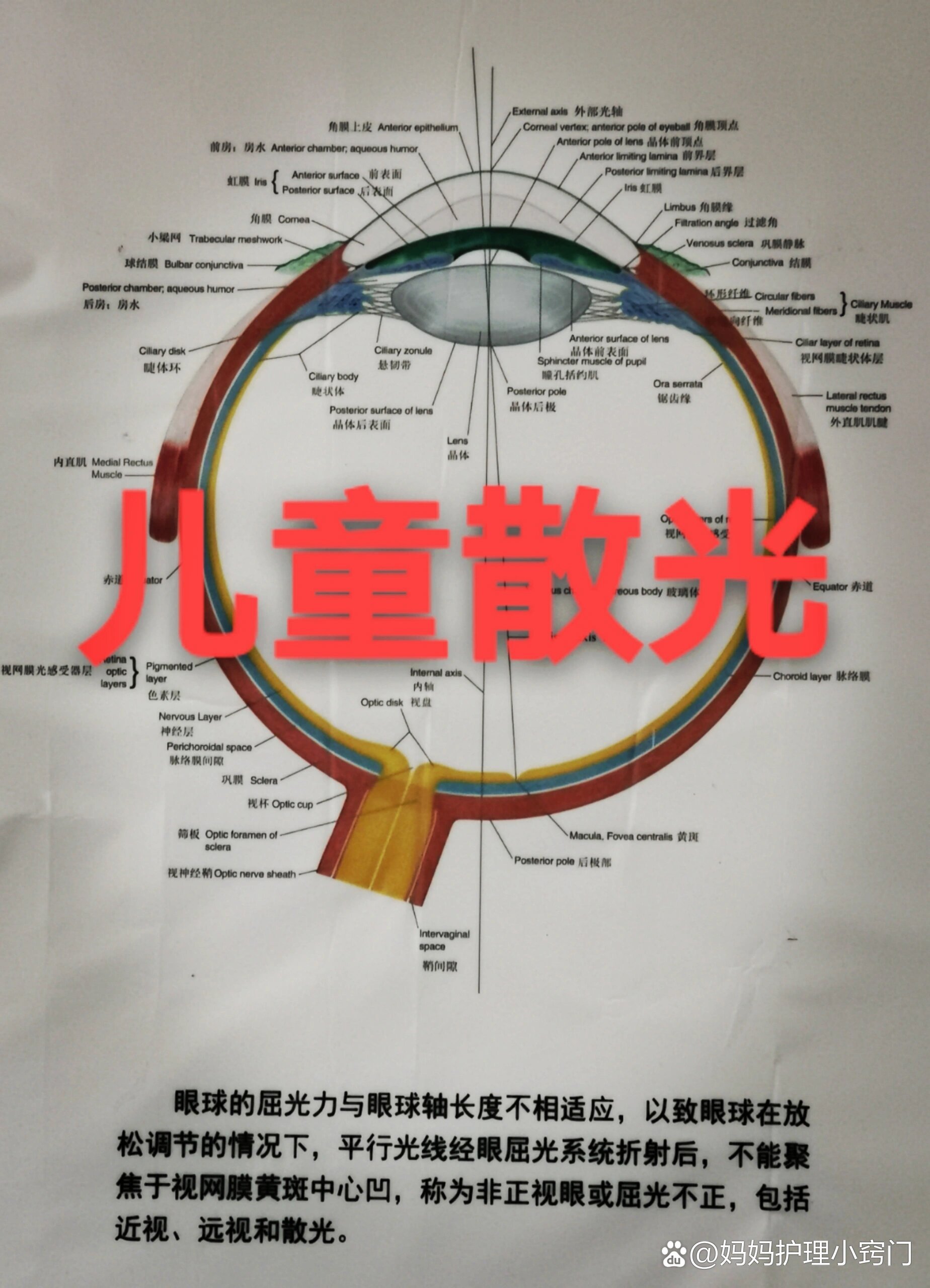 一篇文章了解儿童散光