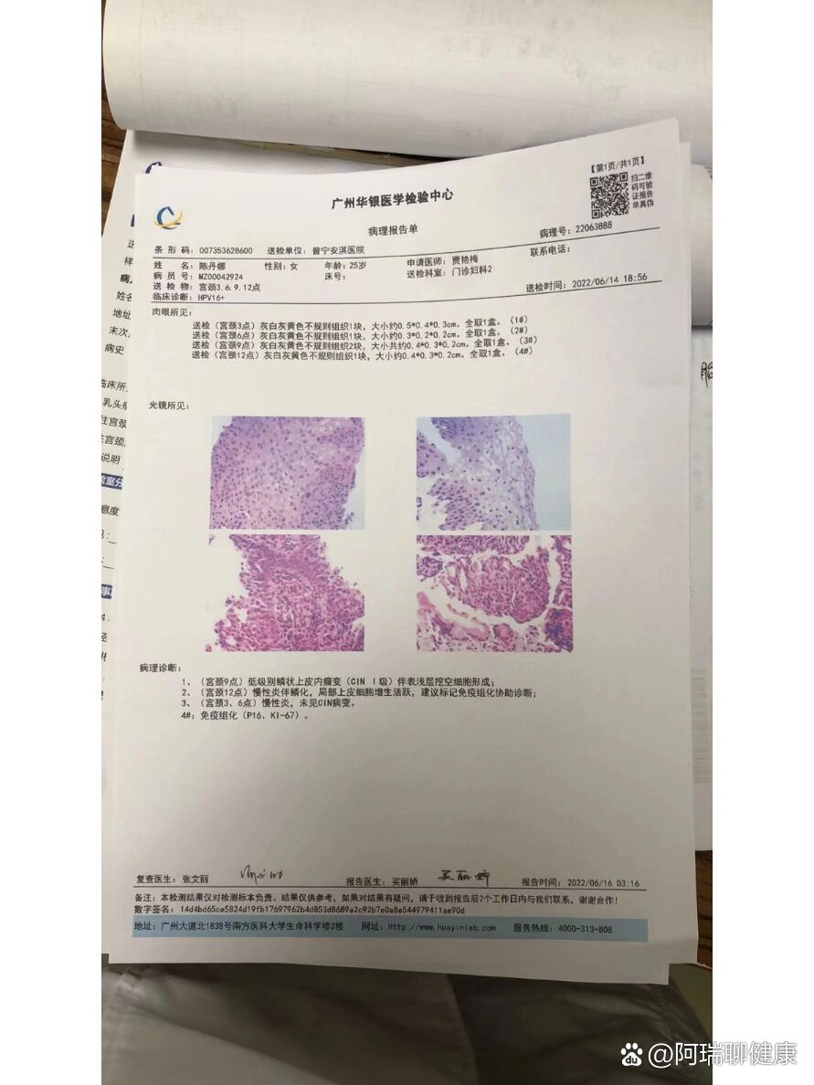 宫颈活检后又建议做免疫组化
