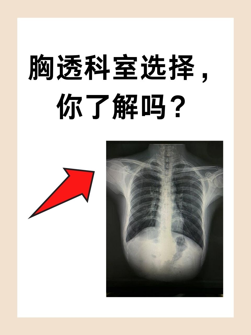 但很多人对于胸透应该挂什么科并不清楚.