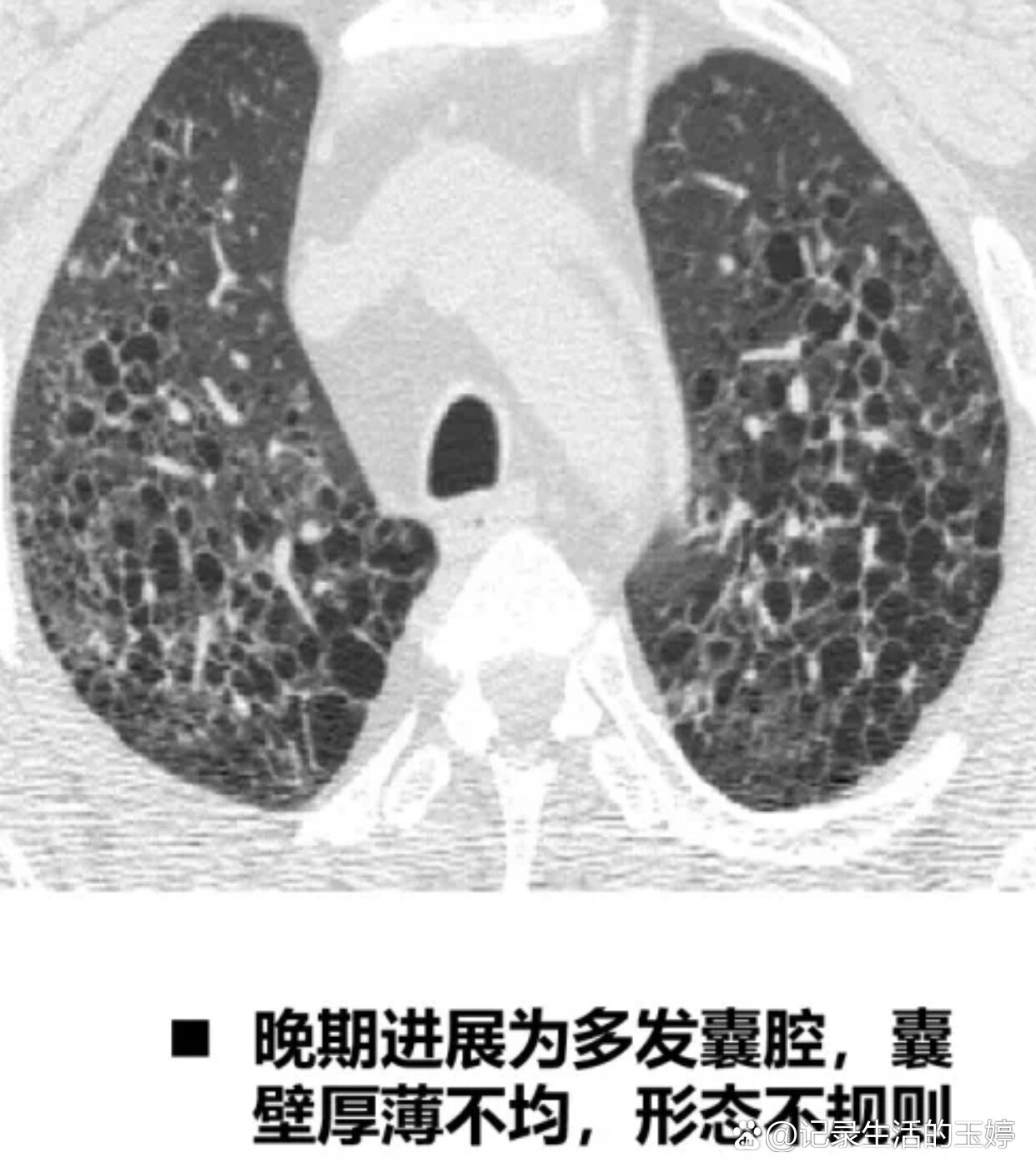 格朗汉斯图片