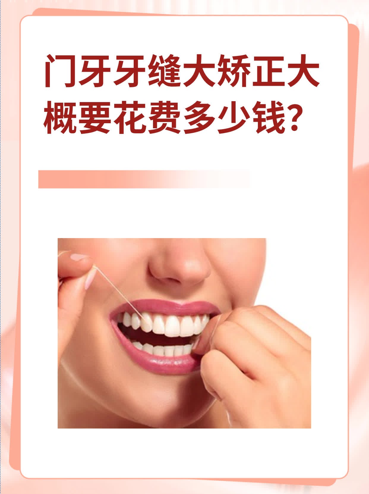 门牙牙缝大矫正大概要花费多少钱