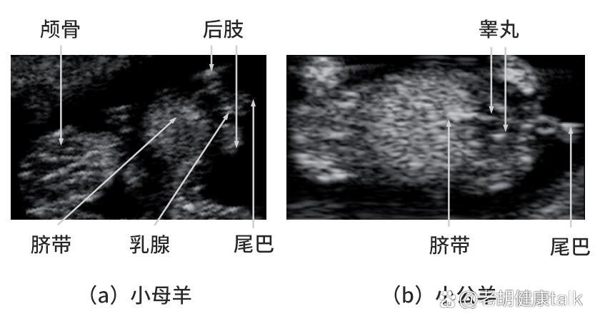 小羊怎么分辨公母图片图片