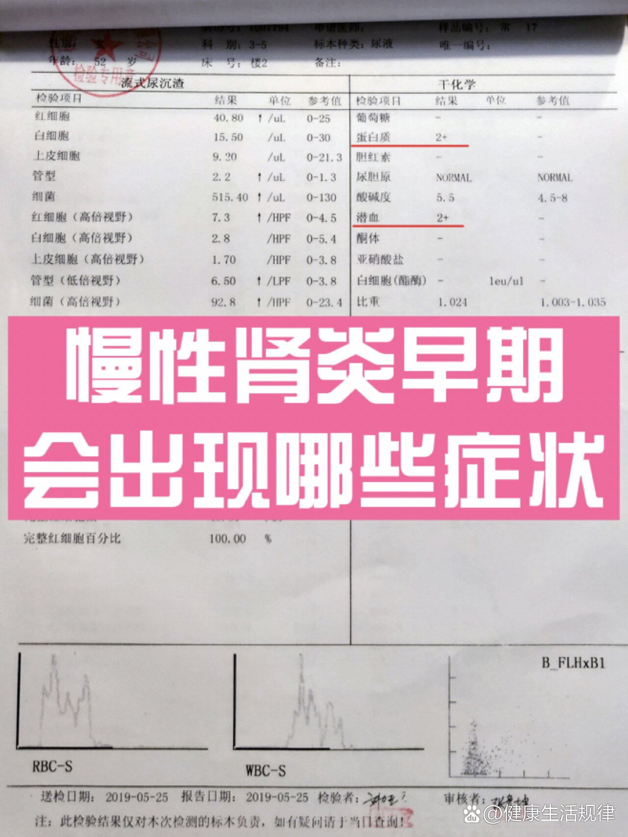 慢性肾炎早期会出现哪些症状?