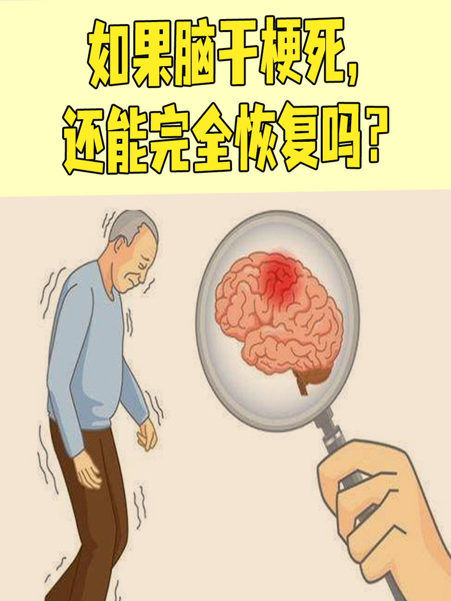 脑干梗死图片