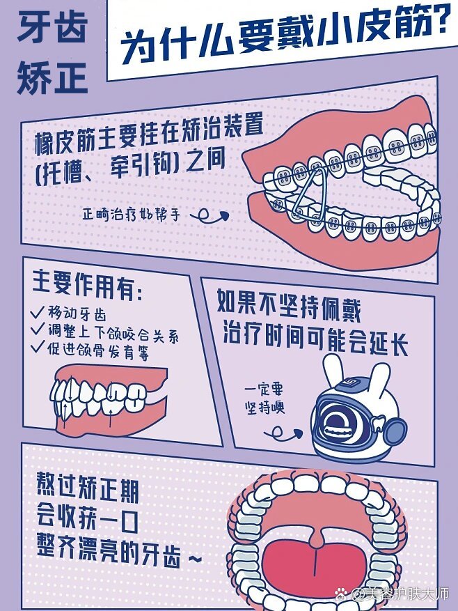 牙齿矫正橡皮筋挂法图片