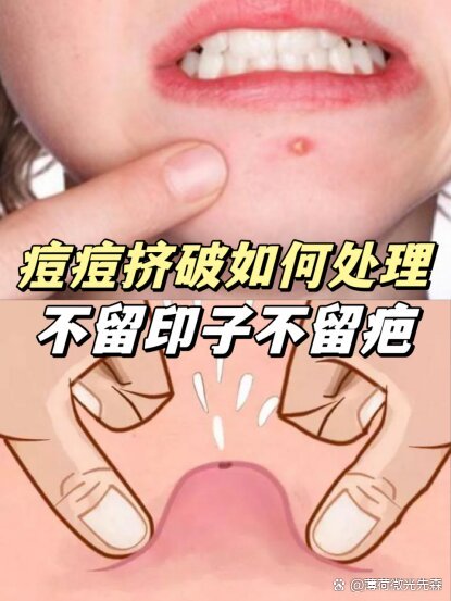 破口痘痘图片