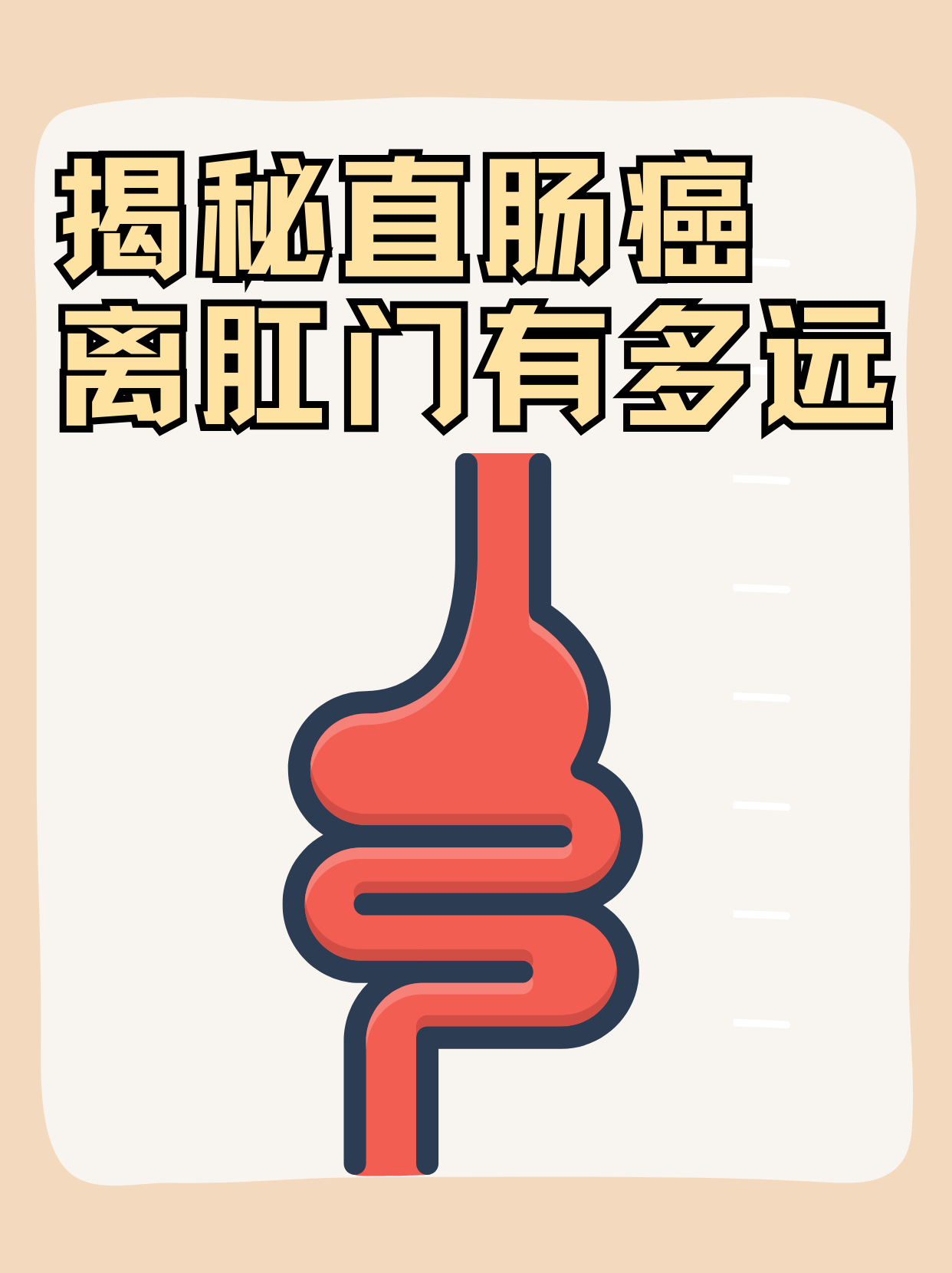 肛门到直肠的距离图片