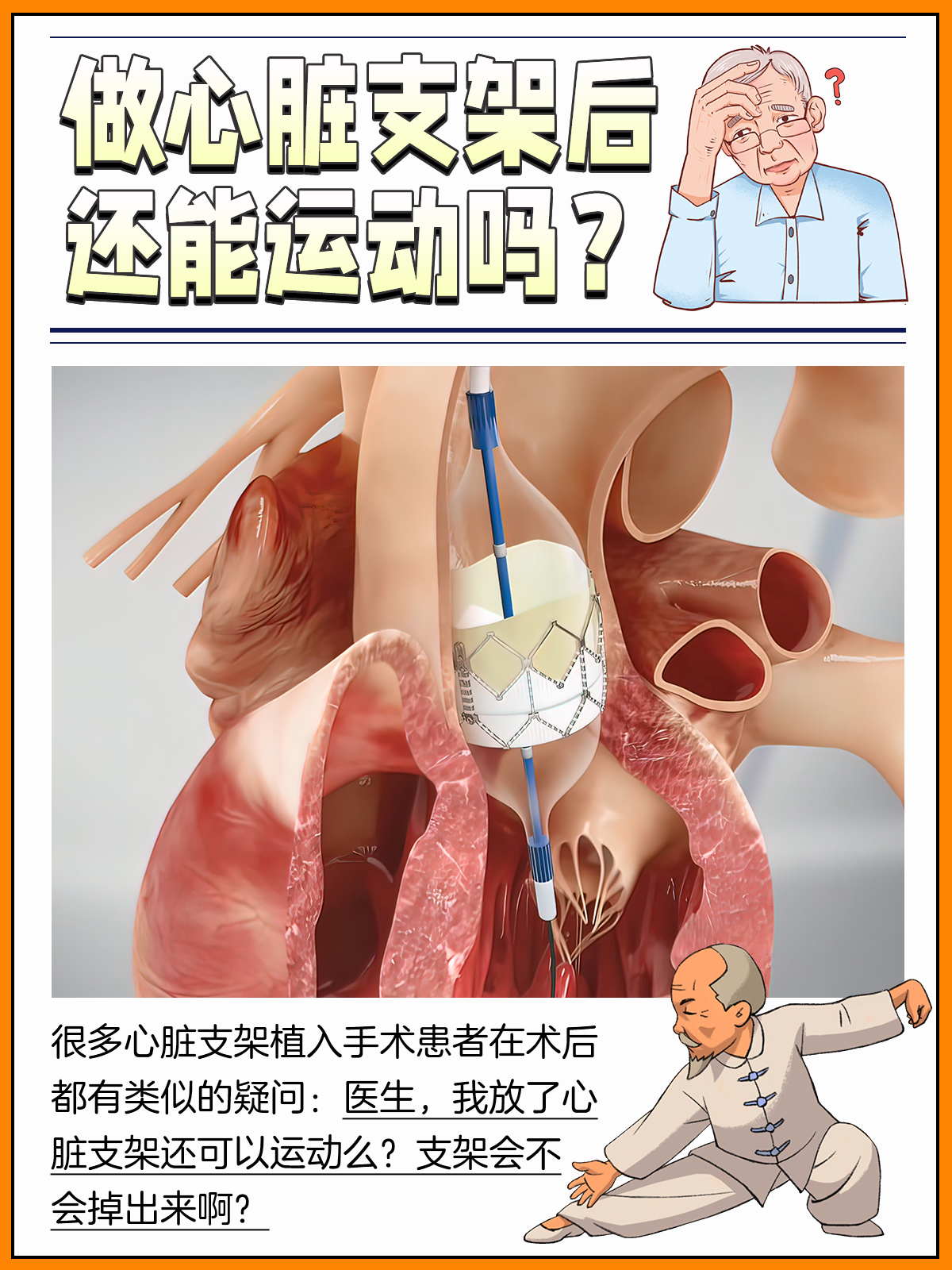 我终于取出了心脏支架图片