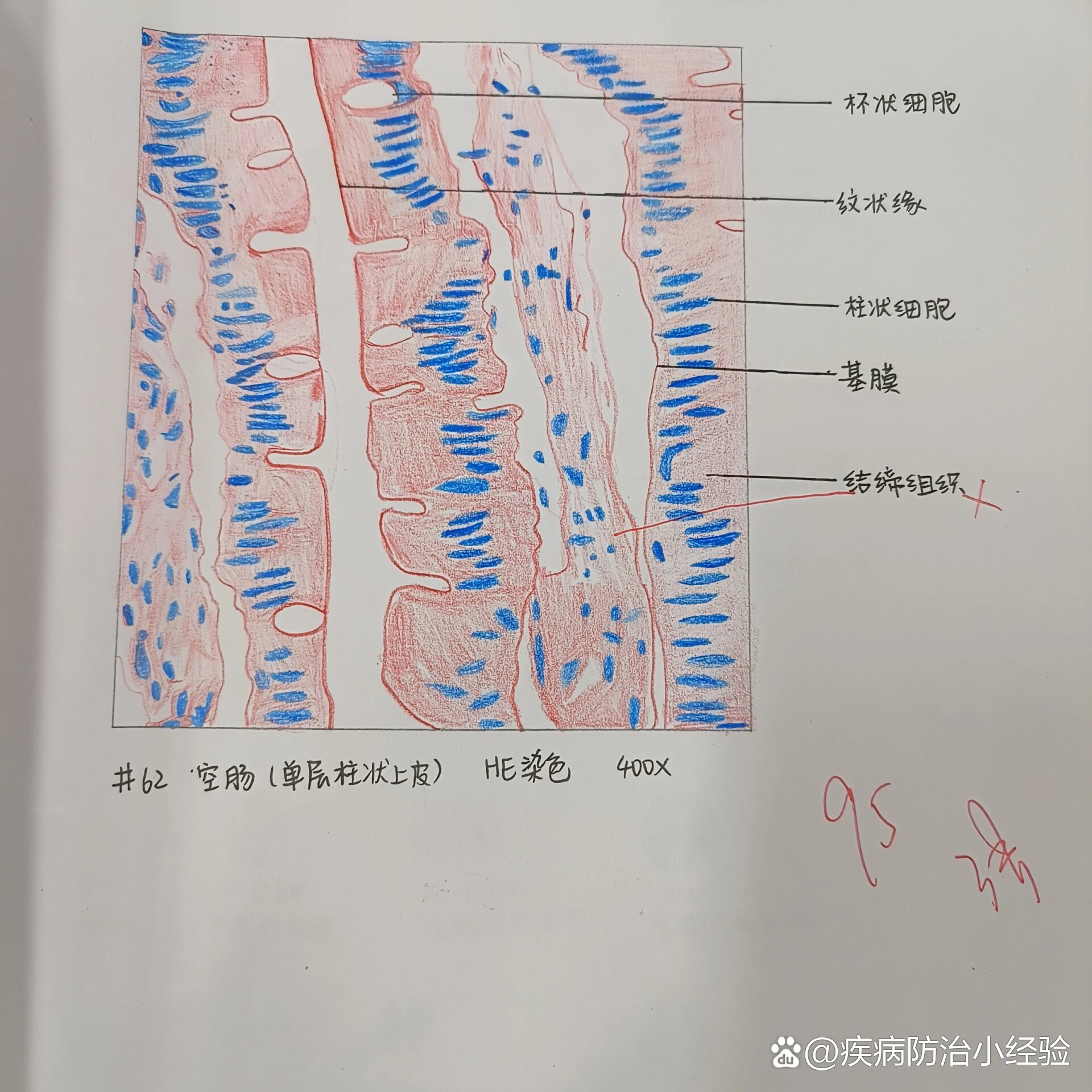 胸腺小体红蓝绘图图片