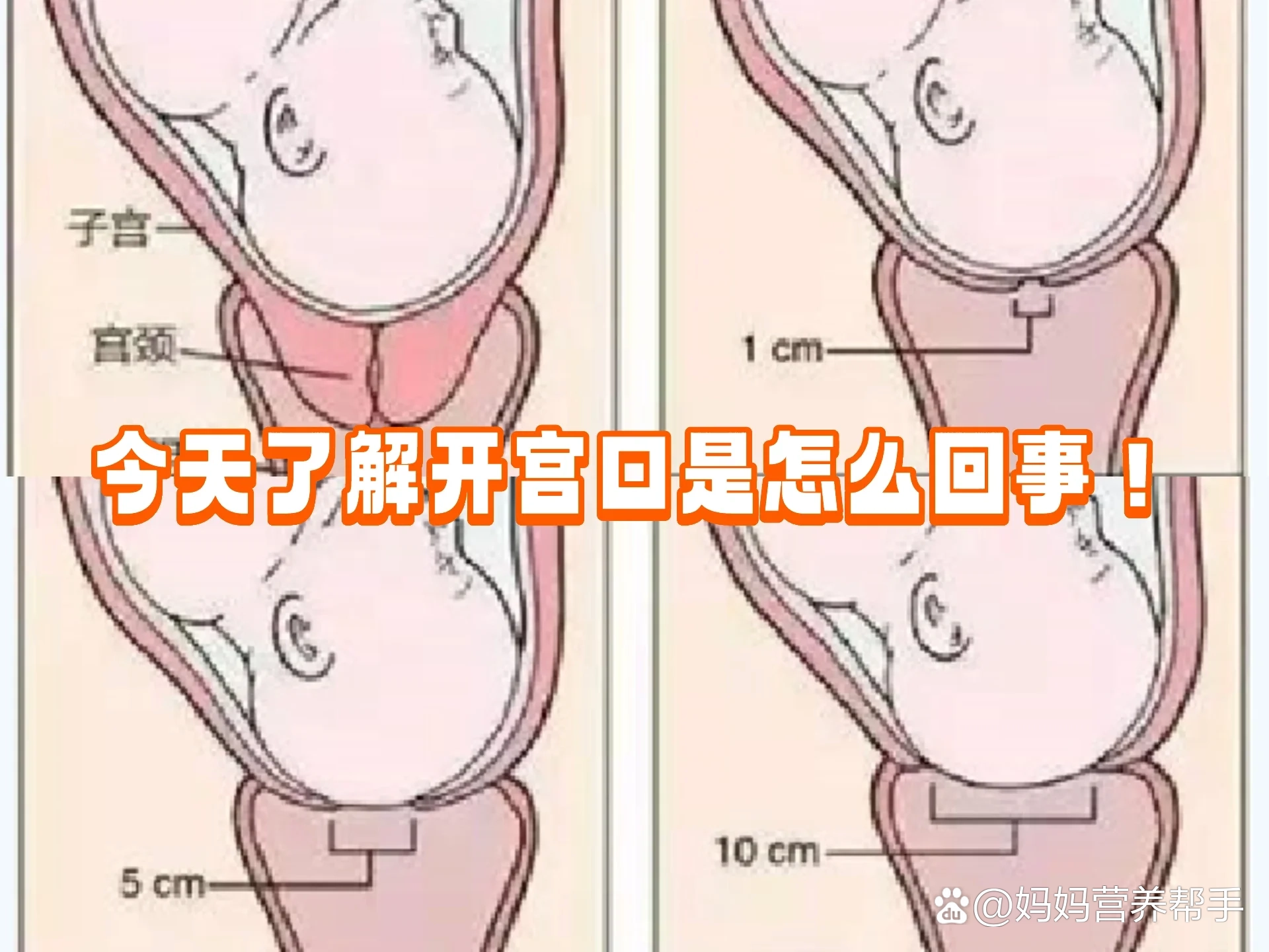 孕10周子宫位置示意图图片