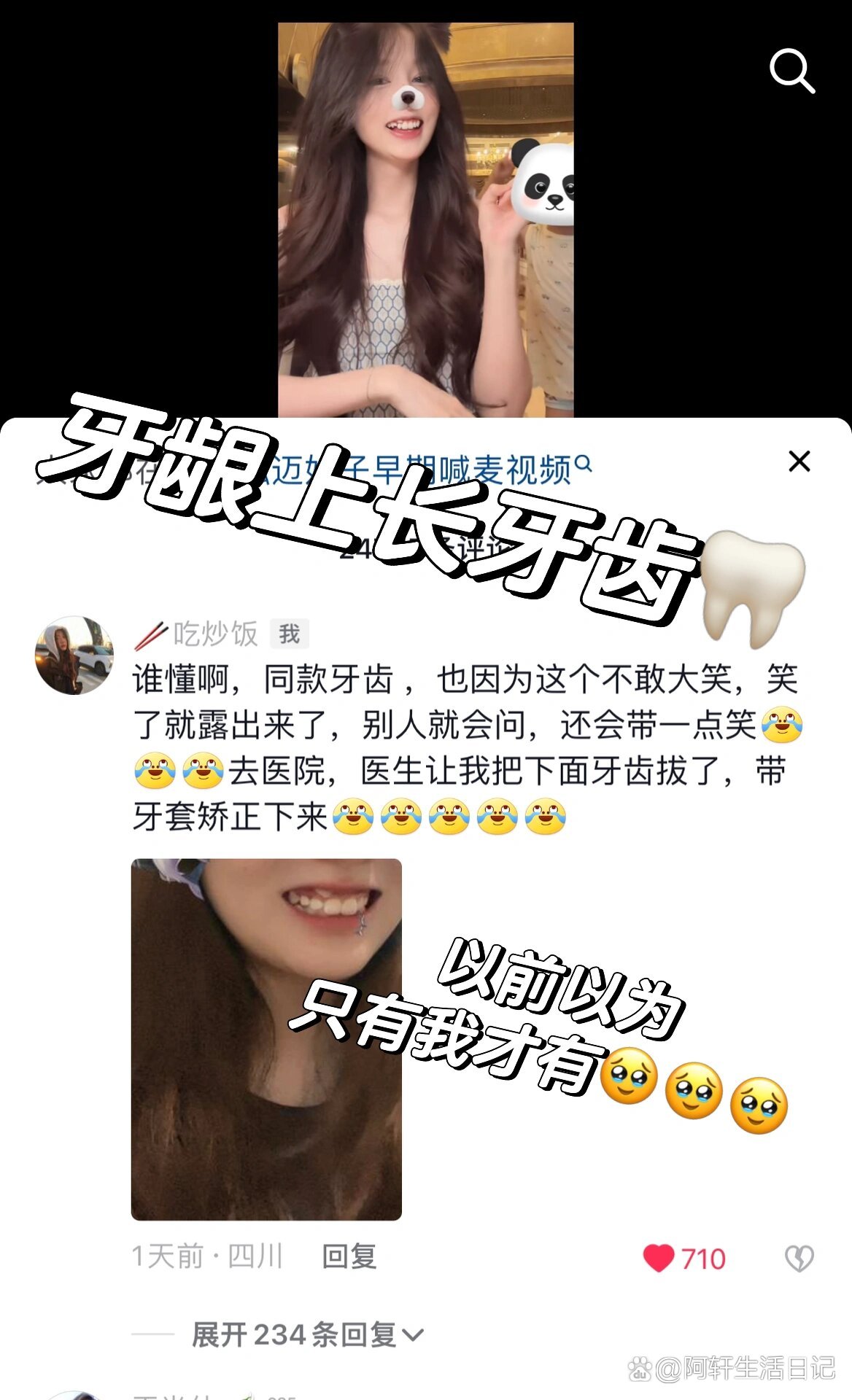 牙龈上长牙齿🦷