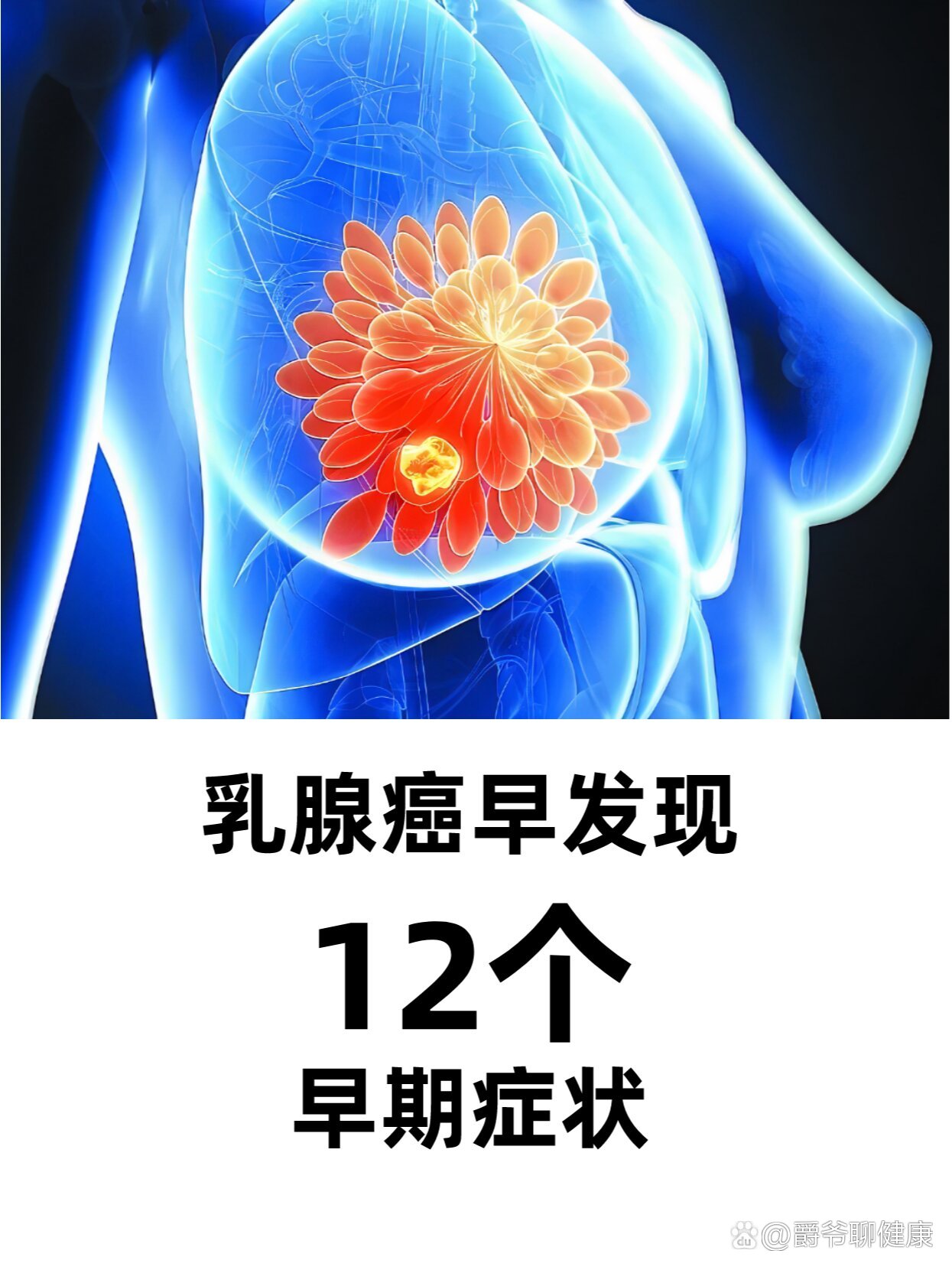 乳腺癌的症状早期征兆图片