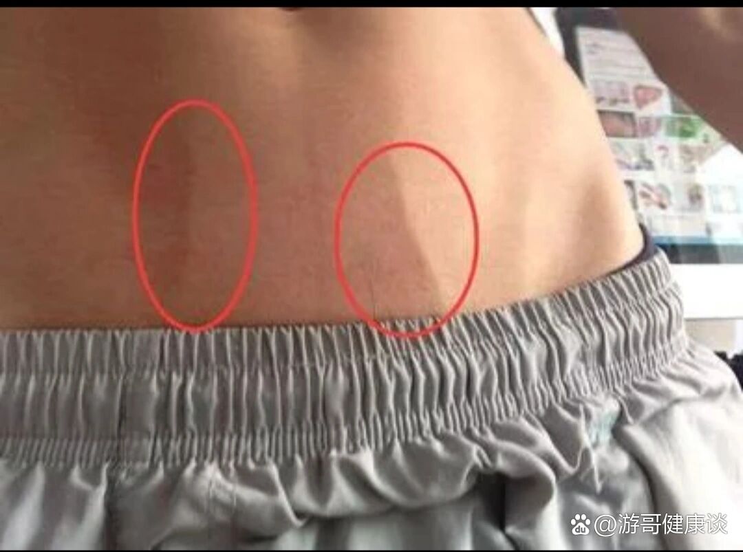 下腔静脉回流受阻,胃肠淤血等,从而导致腹部「青筋凸起」