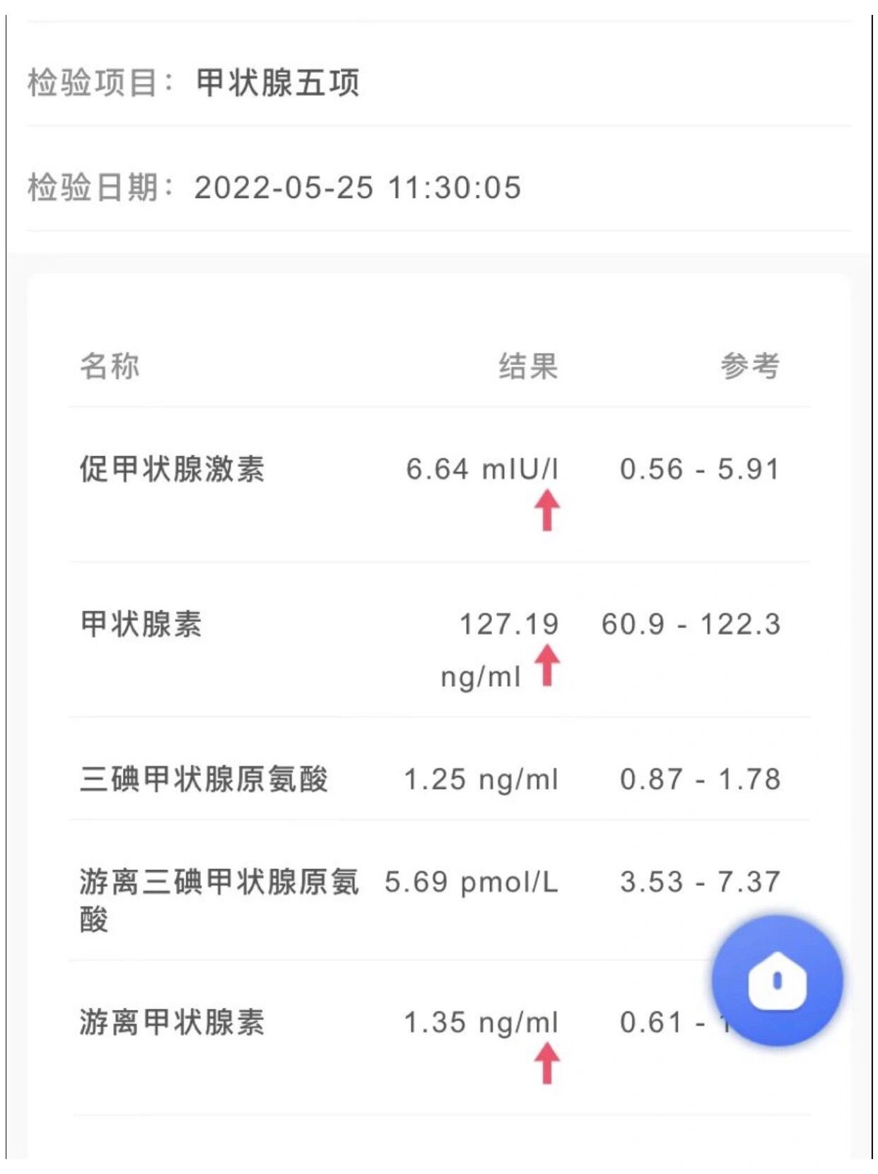 新生儿宝宝甲状腺激素偏高好担心!