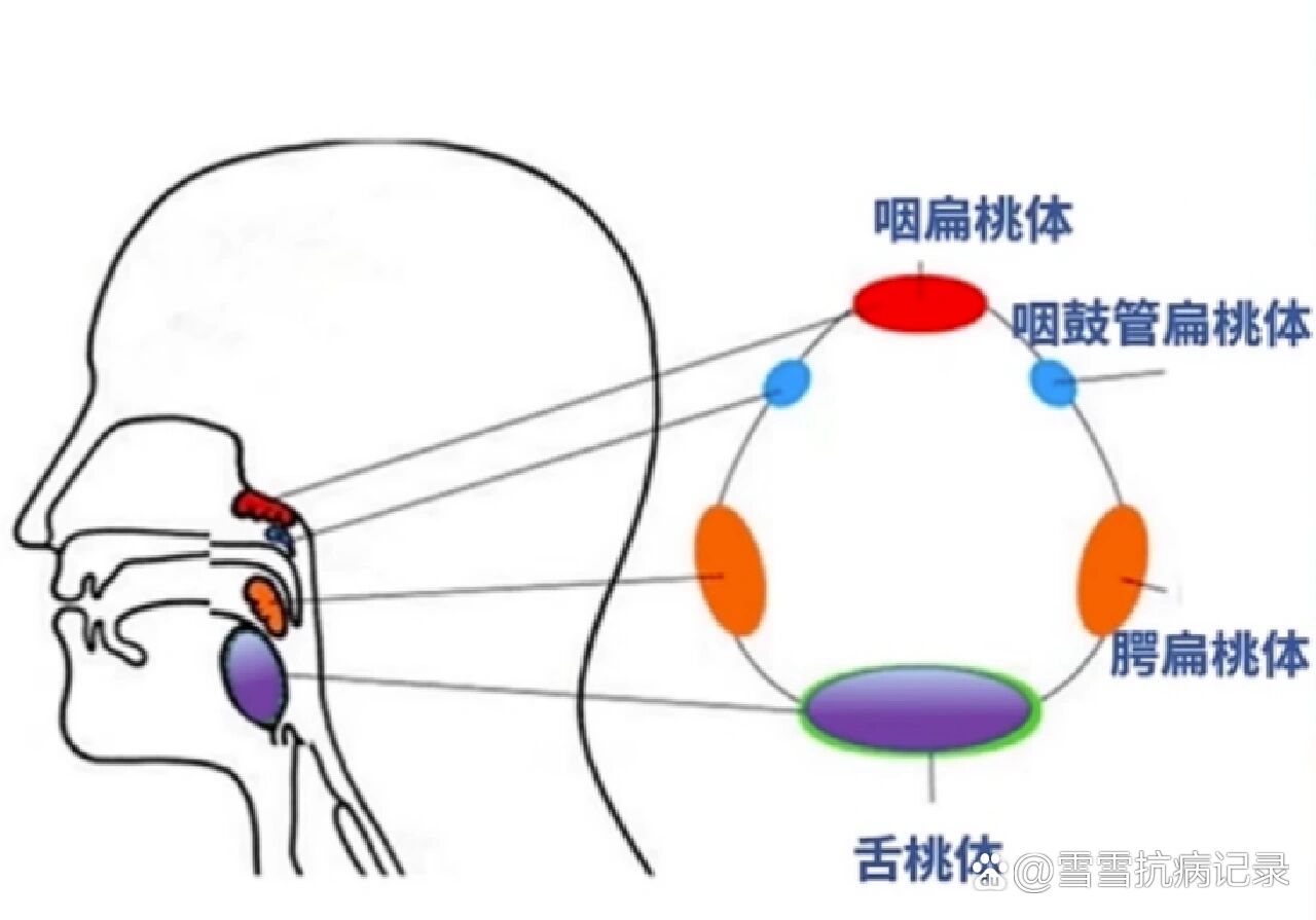 扁桃体在哪位置图片图片