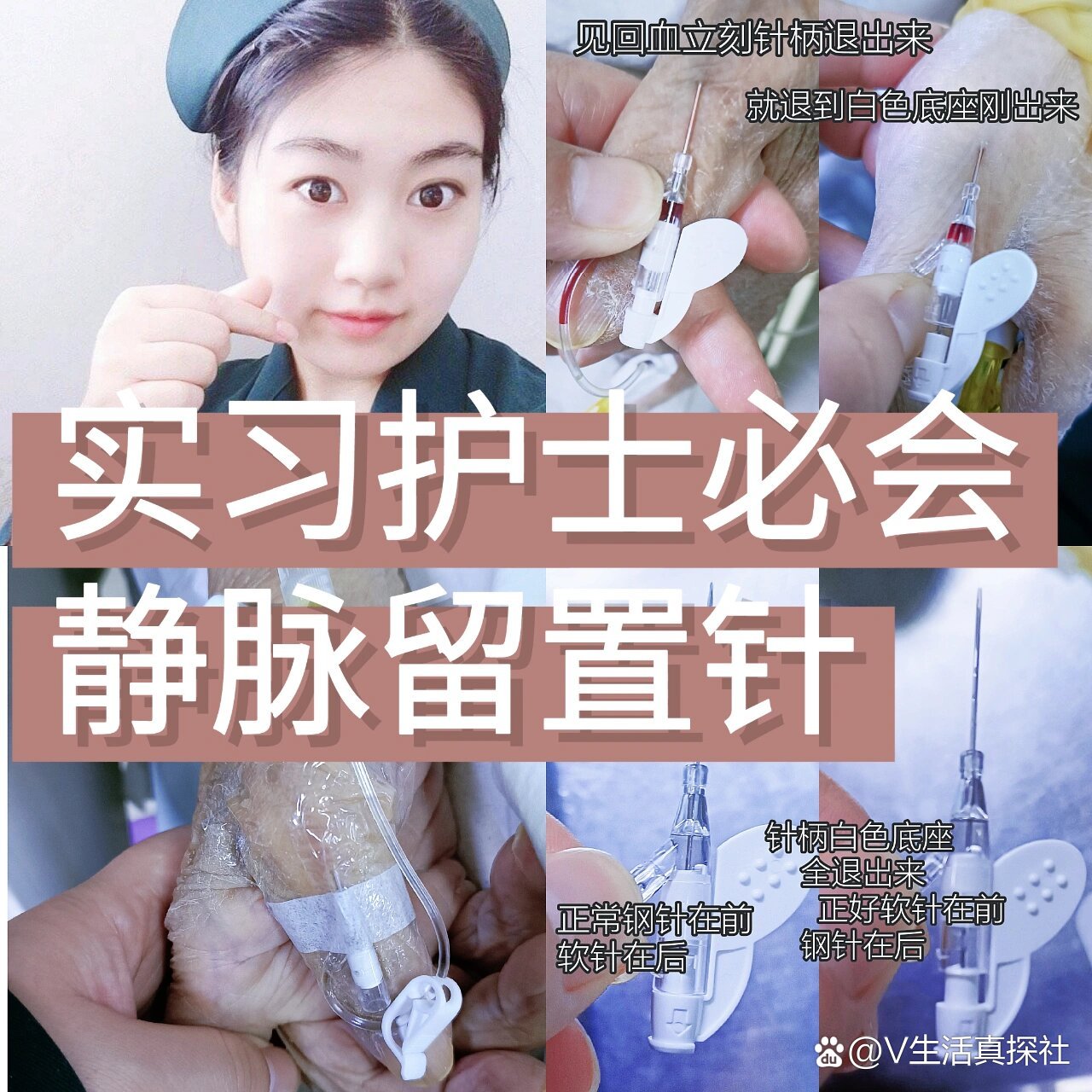 实习护士新手小白必会|扎静脉留置针97