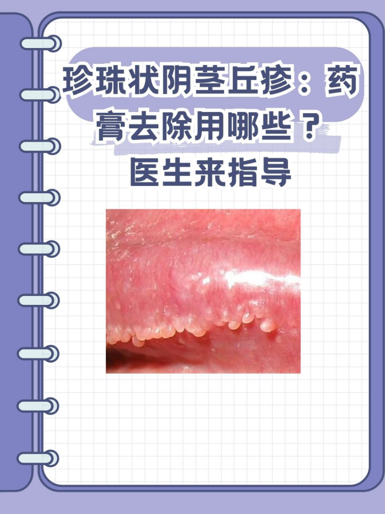 珍珠疹治疗方法图片