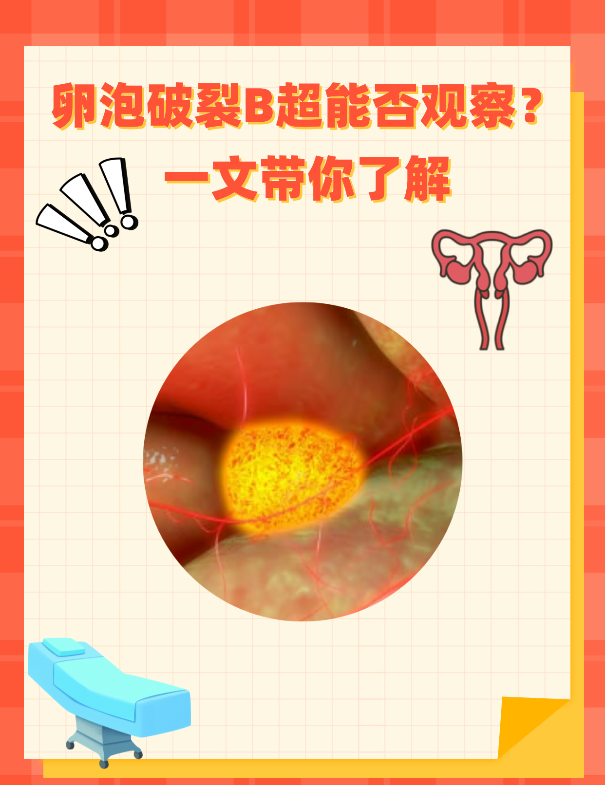 卵子会排出体外(卵泡排出48小时能否受孕)