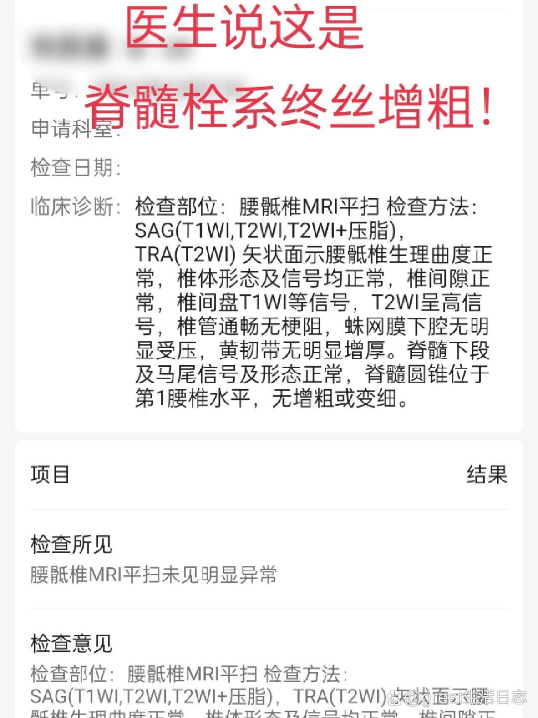 确诊为脊髓栓系终丝增粗