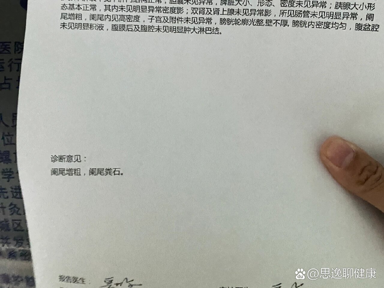 阑尾增粗