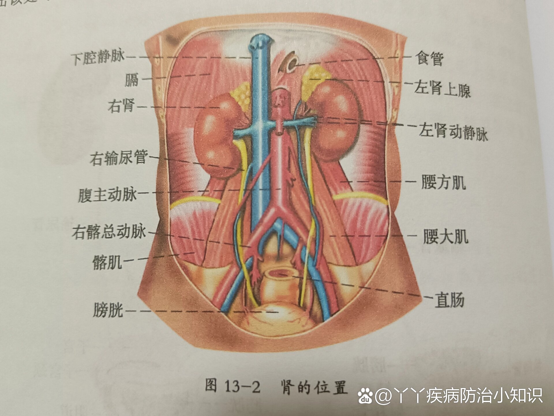 髂内静脉图片