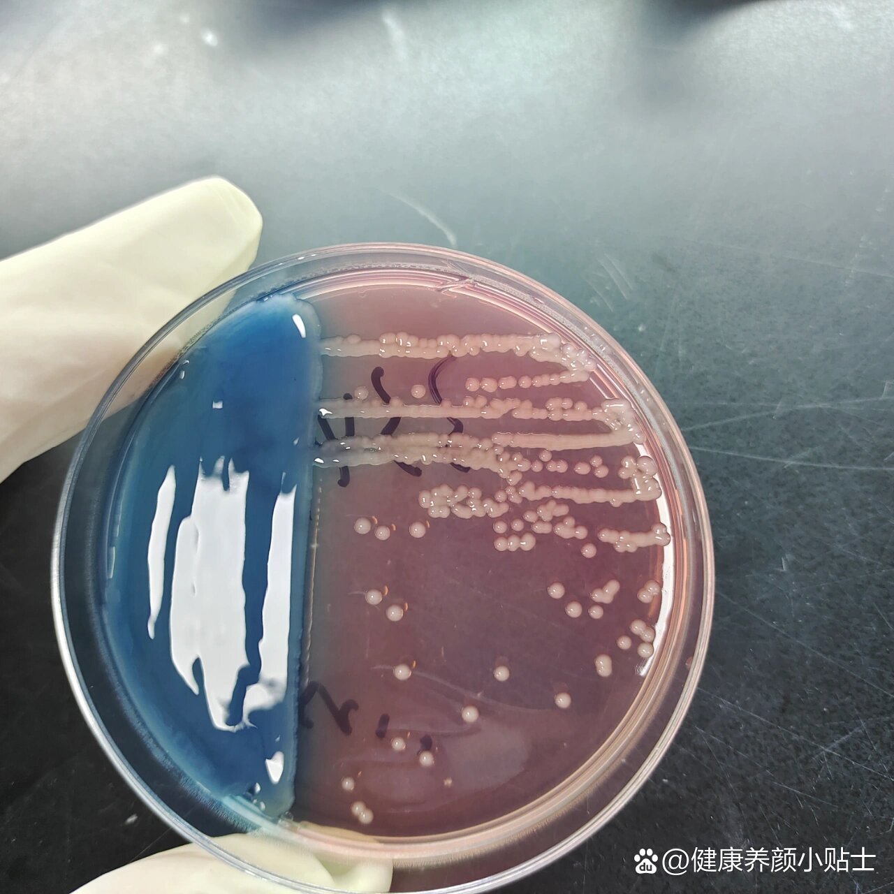 肺炎克雷伯菌 全网资源