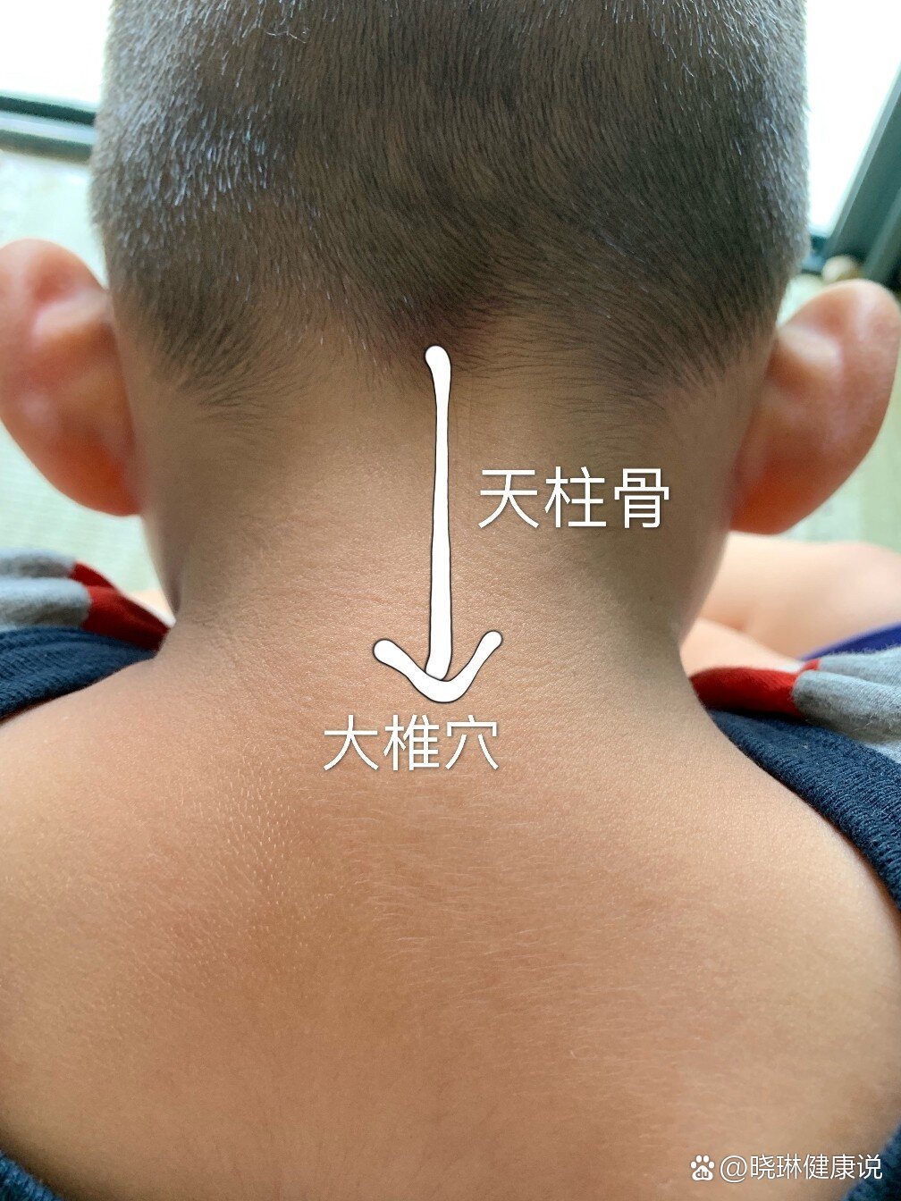 小朋友呕吐怎么办?