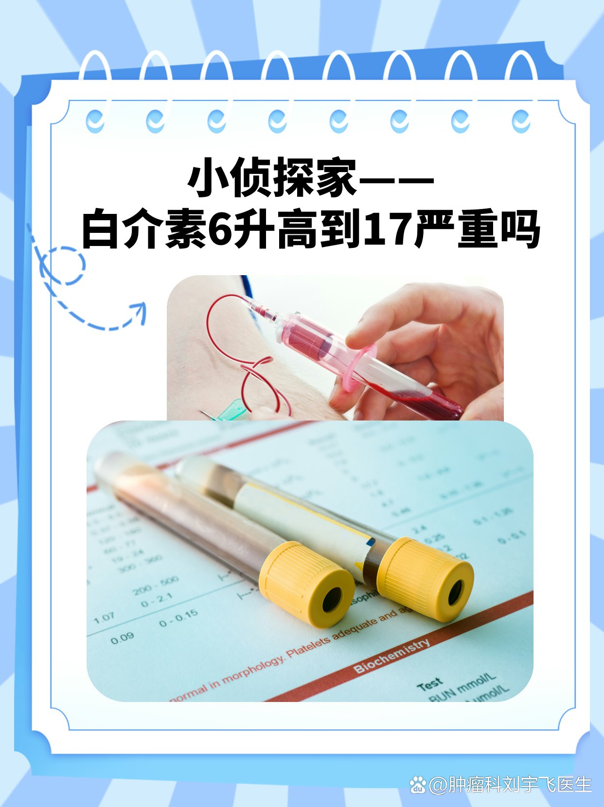 白介素6升高到17ng/L严重吗