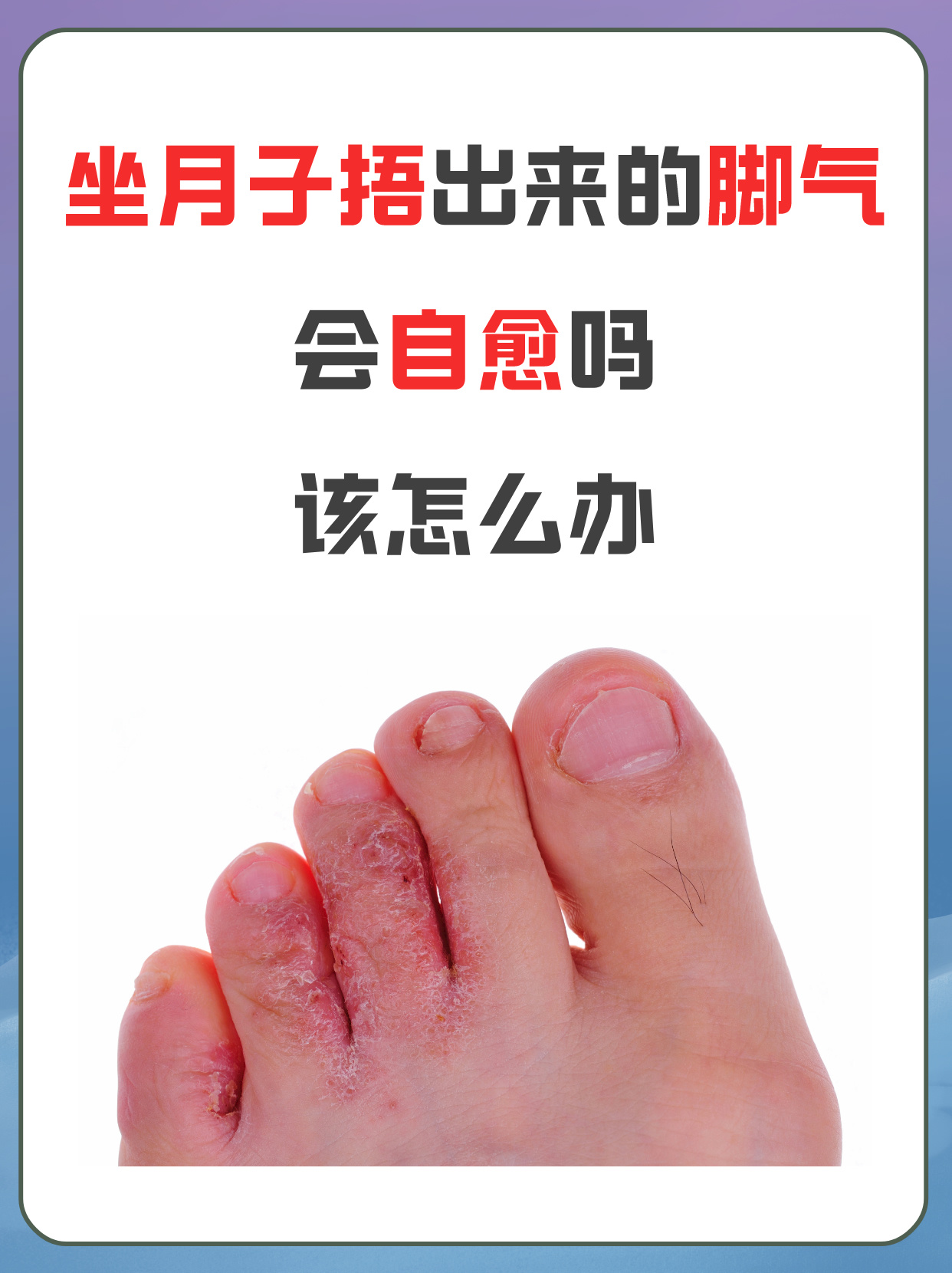 坐月子捂出来的脚气会自愈吗,该怎么办