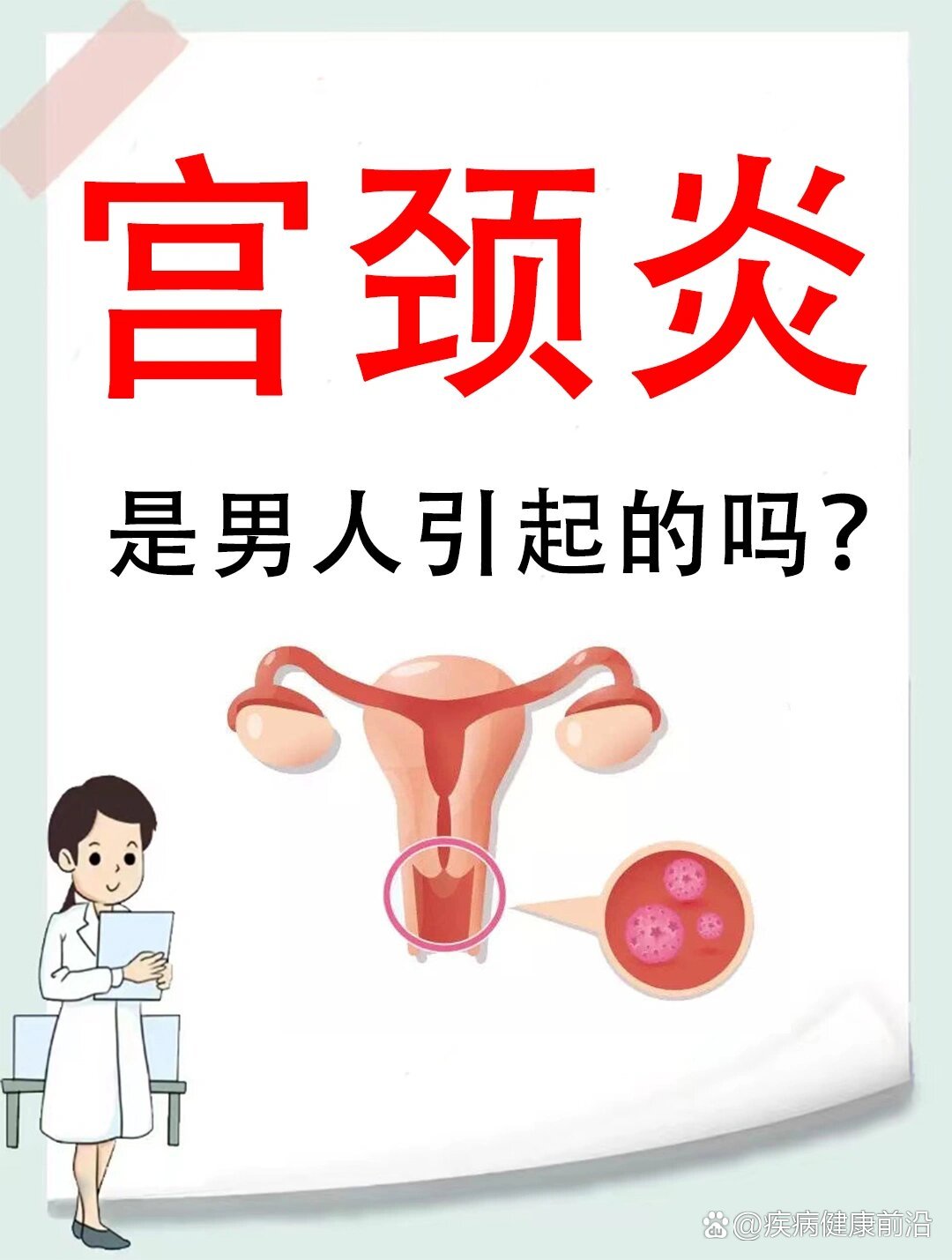 宫颈炎04是男人98引起的吗71