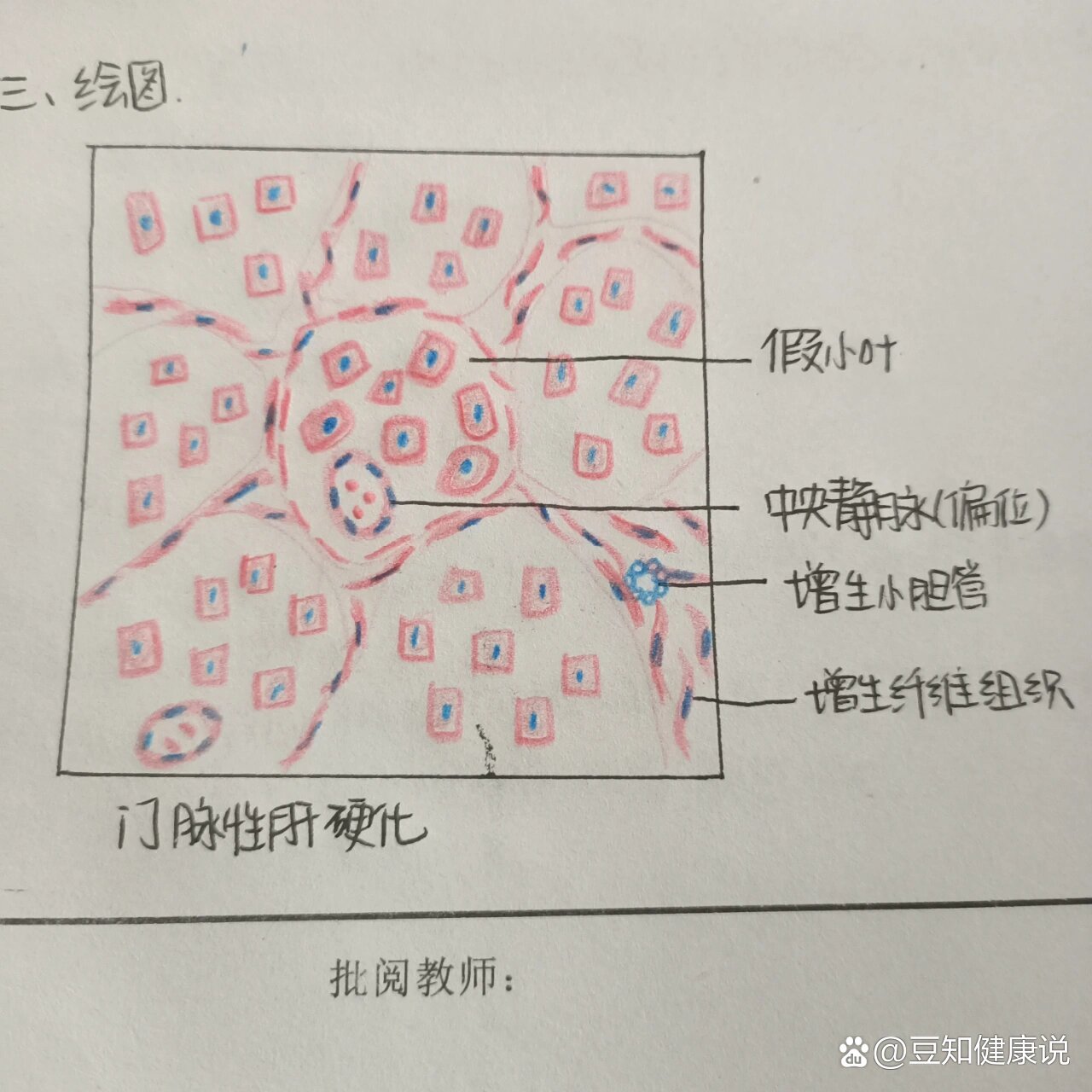 假小叶实验报告手绘图图片