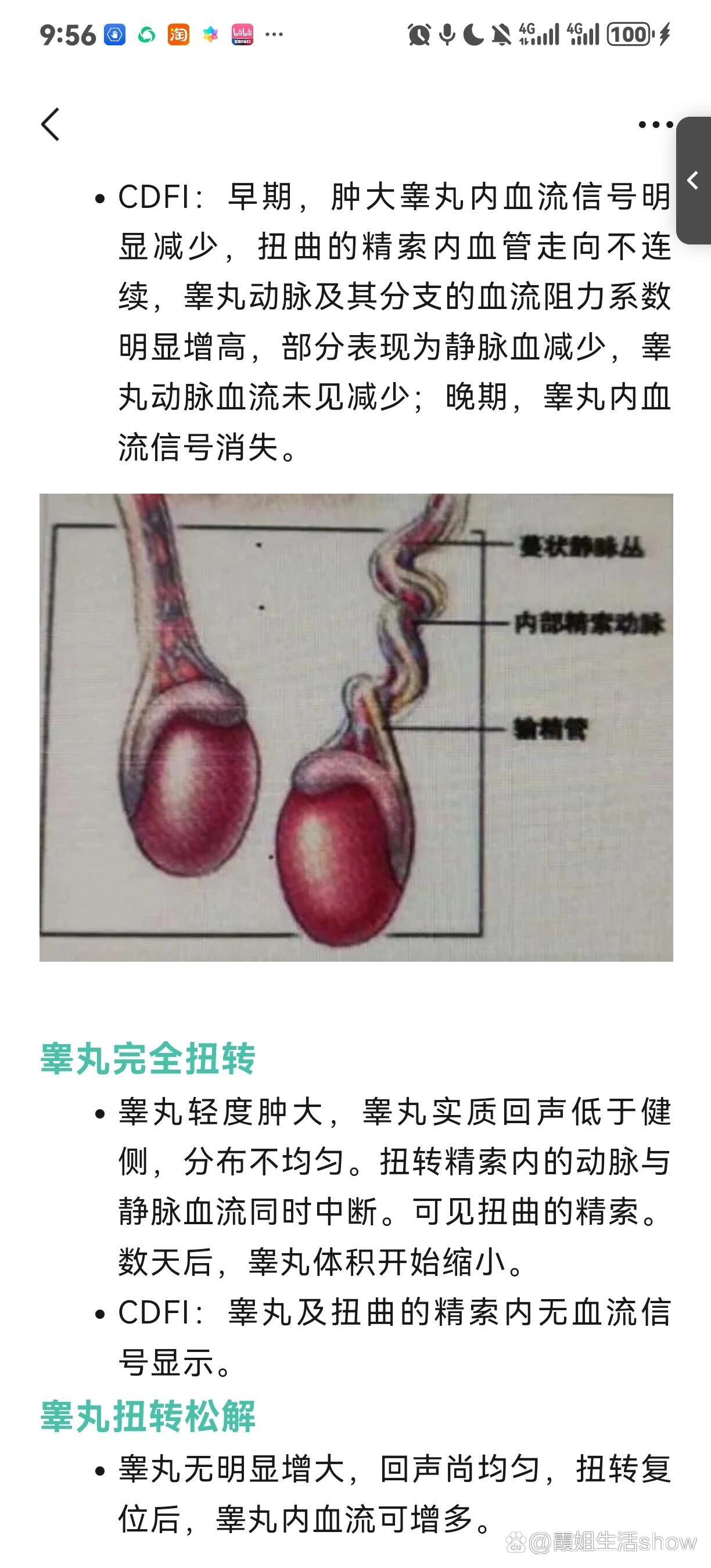 附睾超声测量图图片