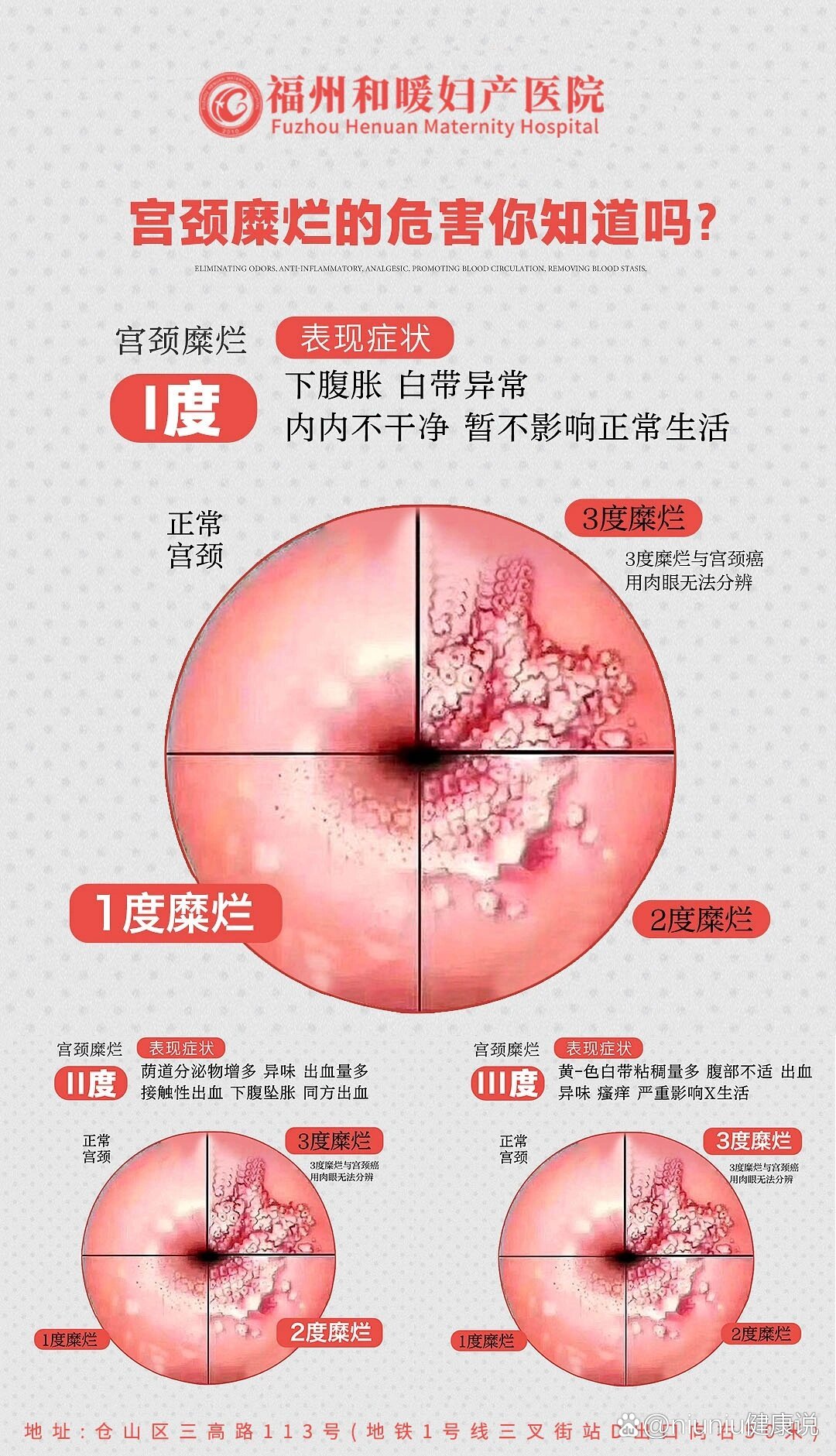 菜花状宫颈糜烂图片图片