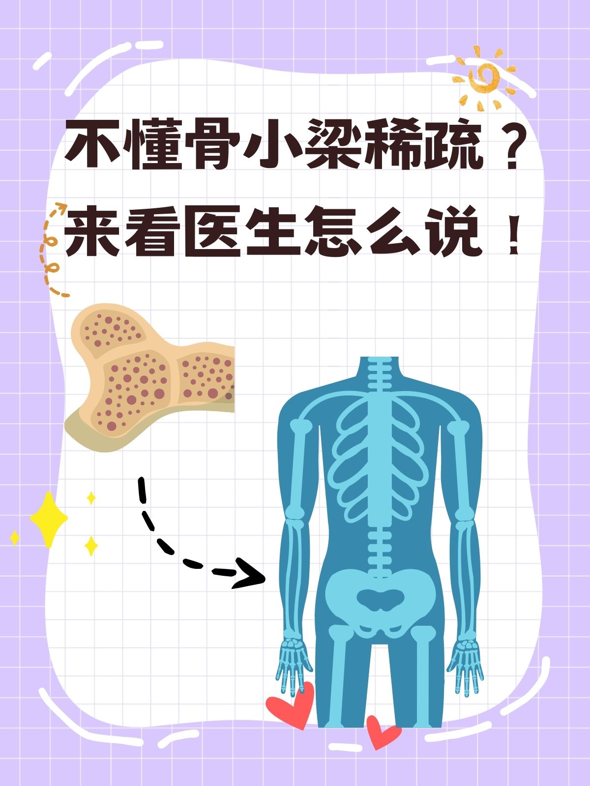 骨小梁中断图片图片