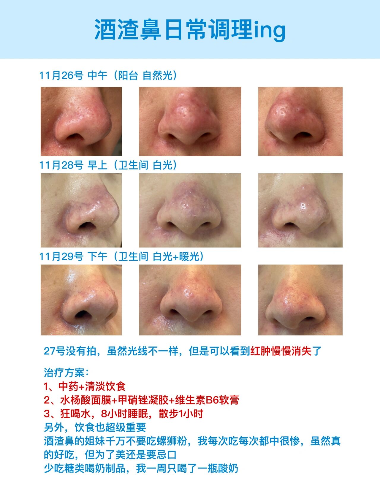 酒渣鼻阶段图片