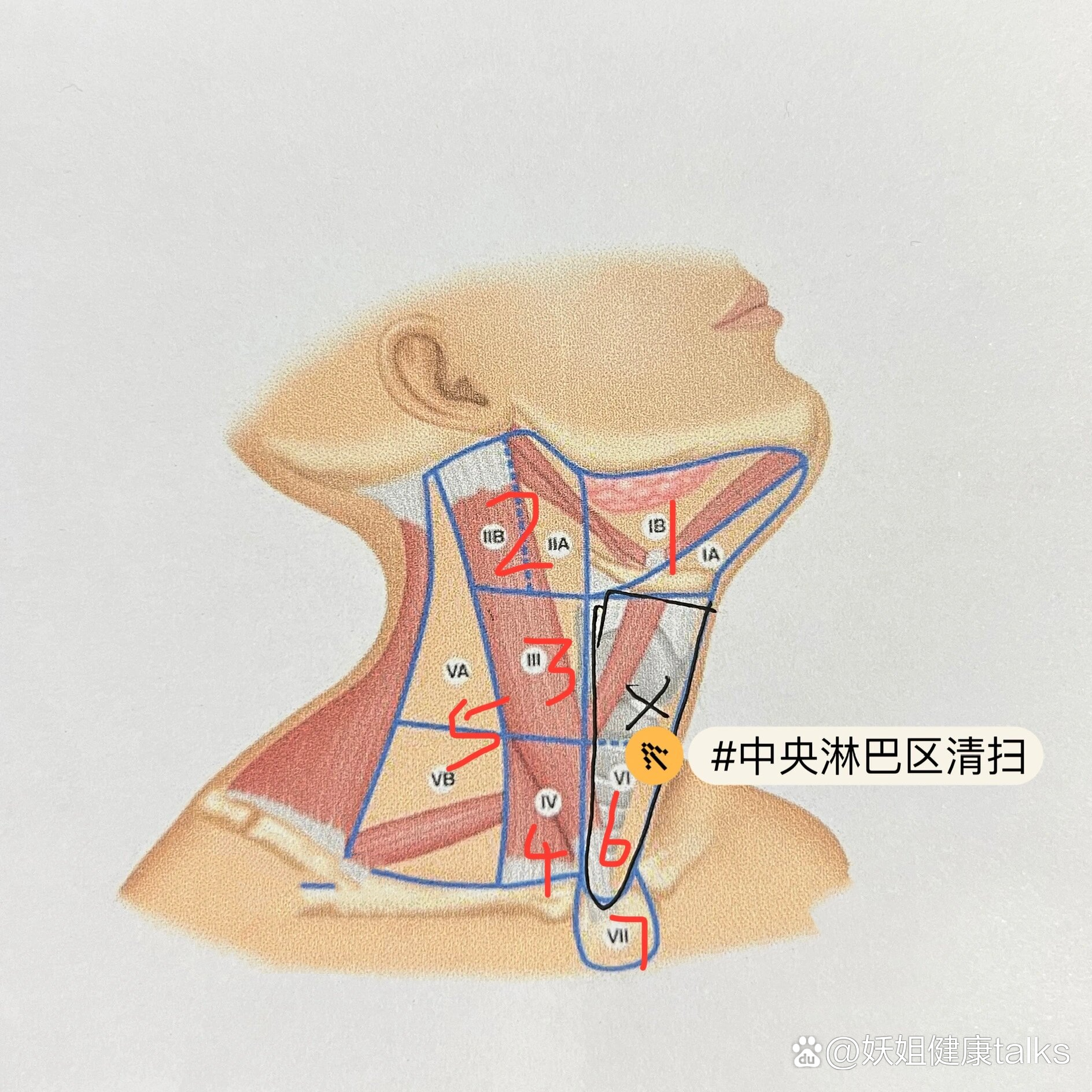 女性甲状腺位置图片