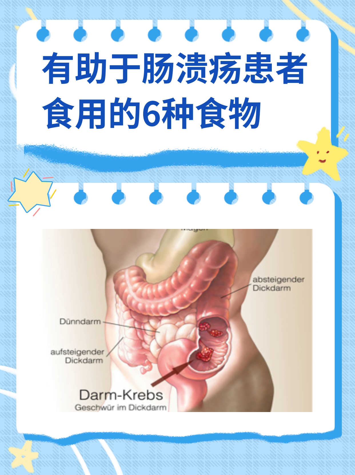 有助于肠溃疡患者食用的6种食物