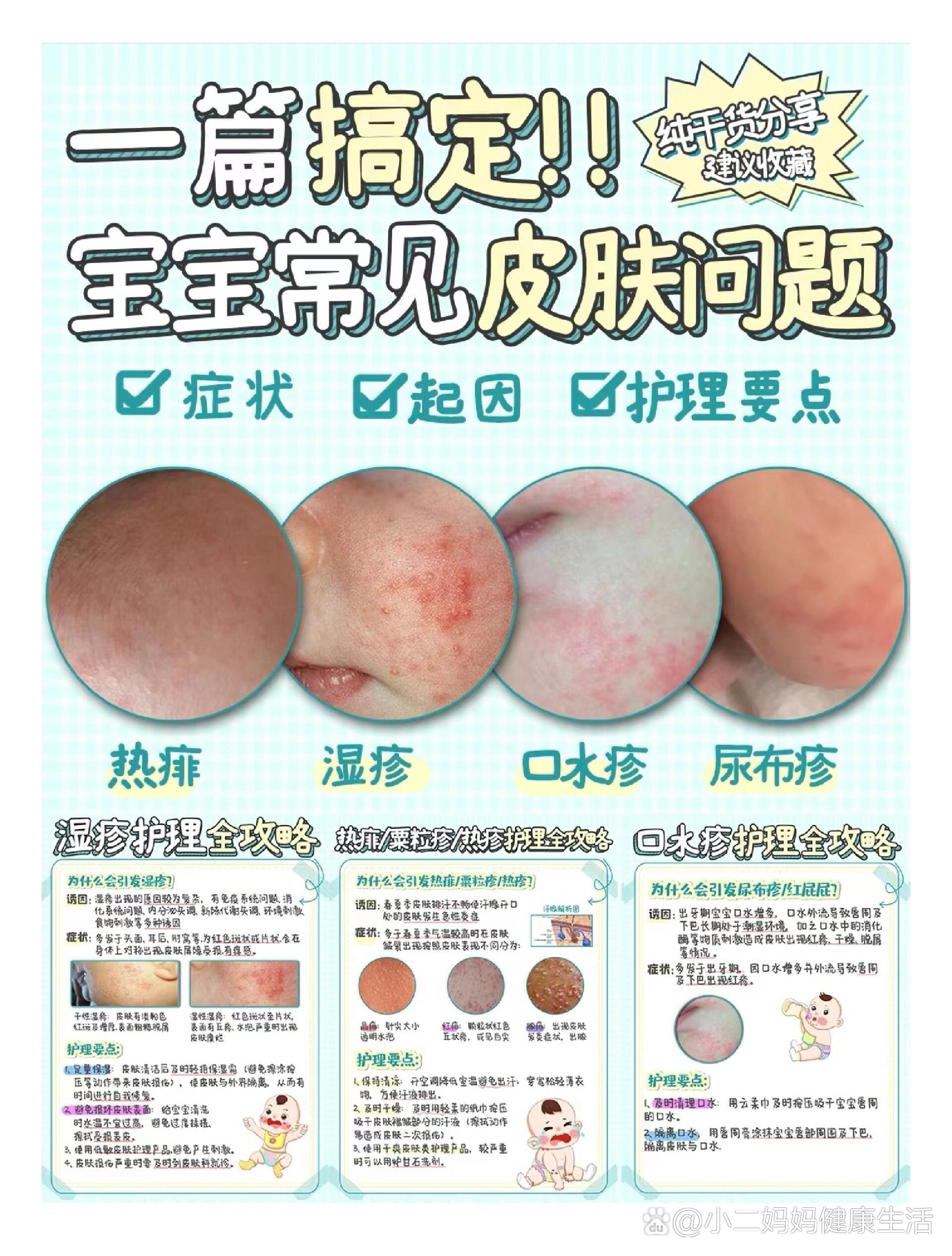 宝宝湿疹/口水疹/尿布疹一次性讲明白