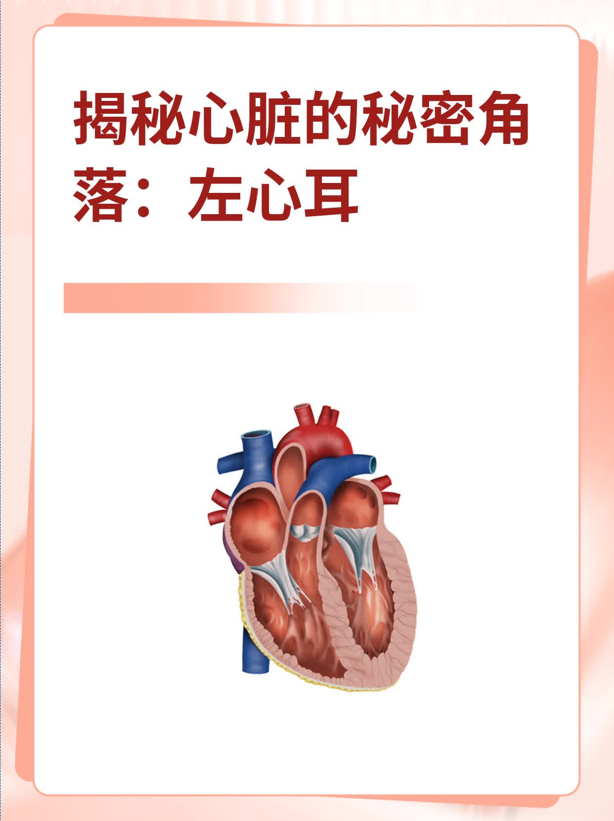 揭秘心脏的秘密角落:左心耳