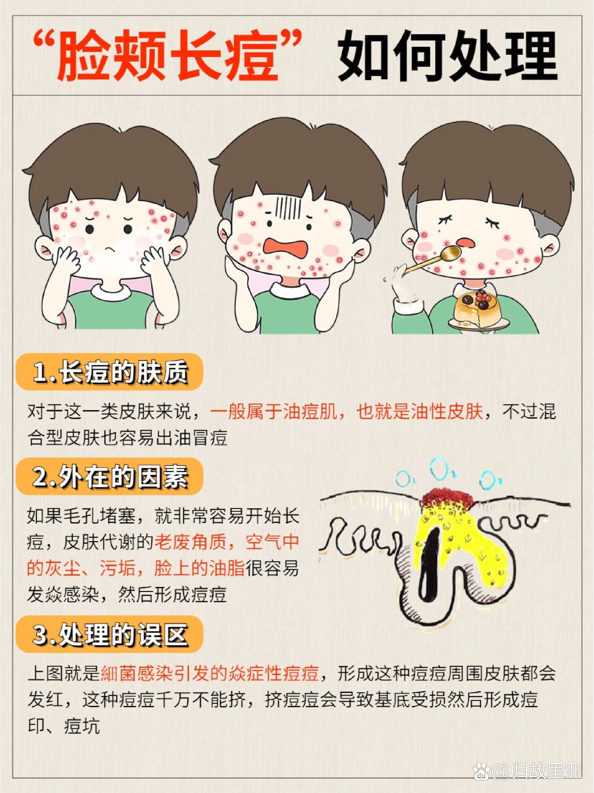 脸颊长痘怎么办93保姆级分享超详细教程73